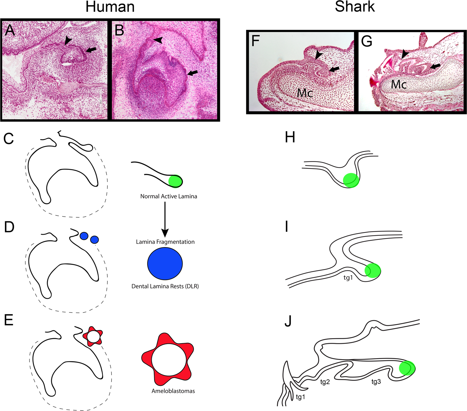 Shark tooth regeneration reveals common stem cell characters in both human  rested lamina and ameloblastoma | Scientific Reports