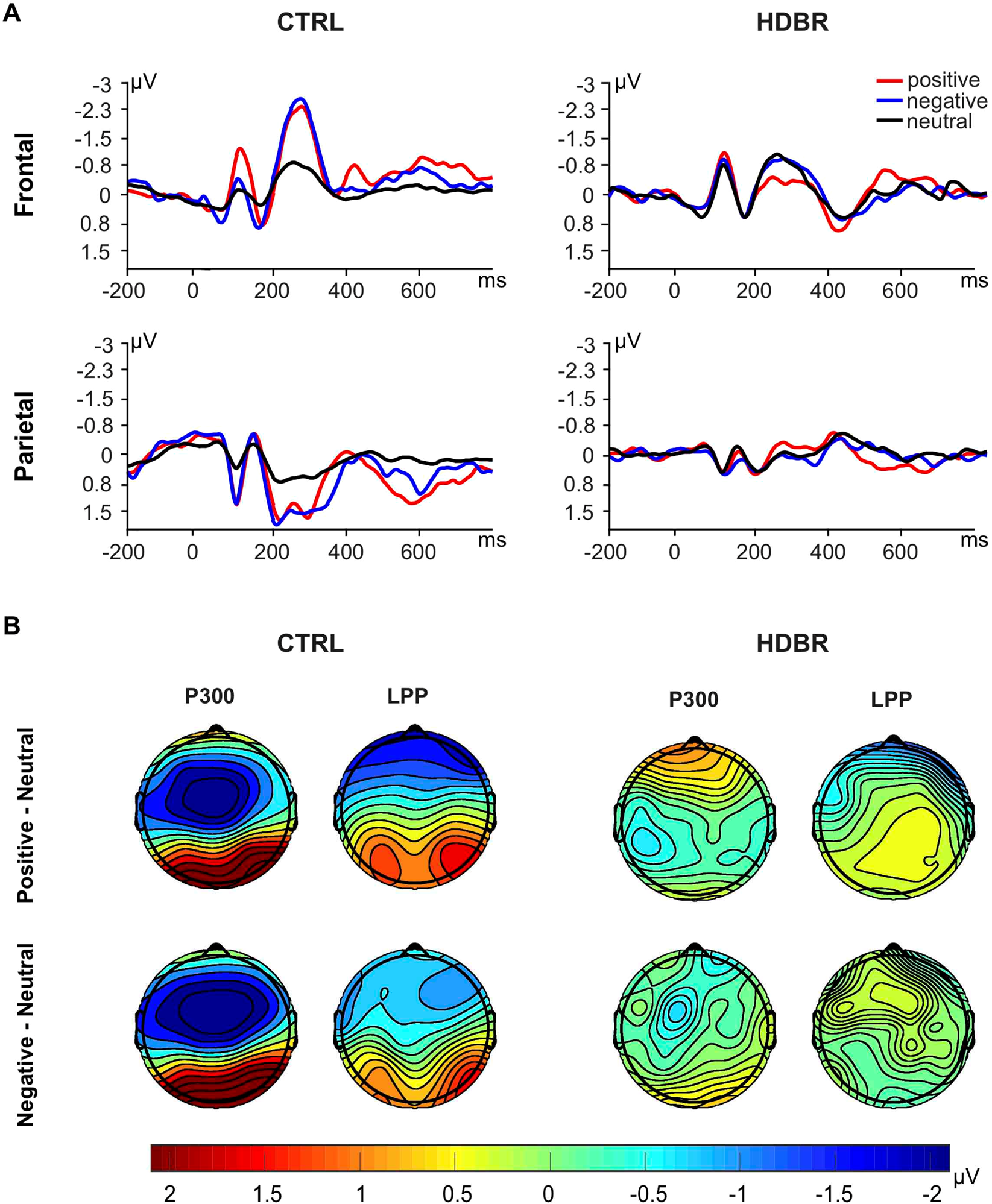 Electrocortical Evidence For Impaired Affective Picture