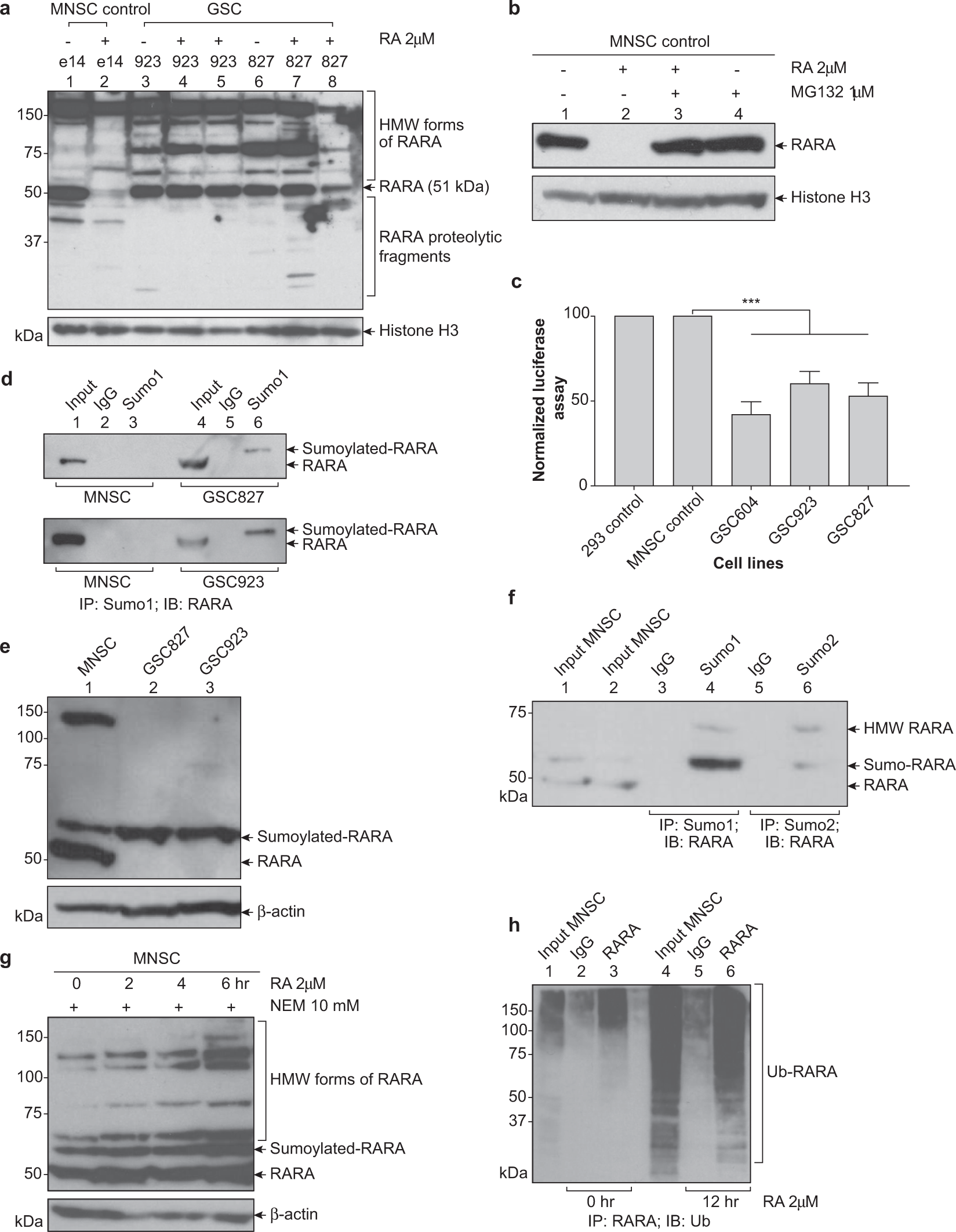 Retinoid Receptor Turnover Mediated By Sumoylation Ubiquitination And The Valosin Containing Protein Is Disrupted In Glioblastoma Scientific Reports Retinoid Receptor Turnover Mediated By Sumoylation Ubiquitination And The Valosin Containing Protein Is Disrupted In Glioblastoma Scientific Reports