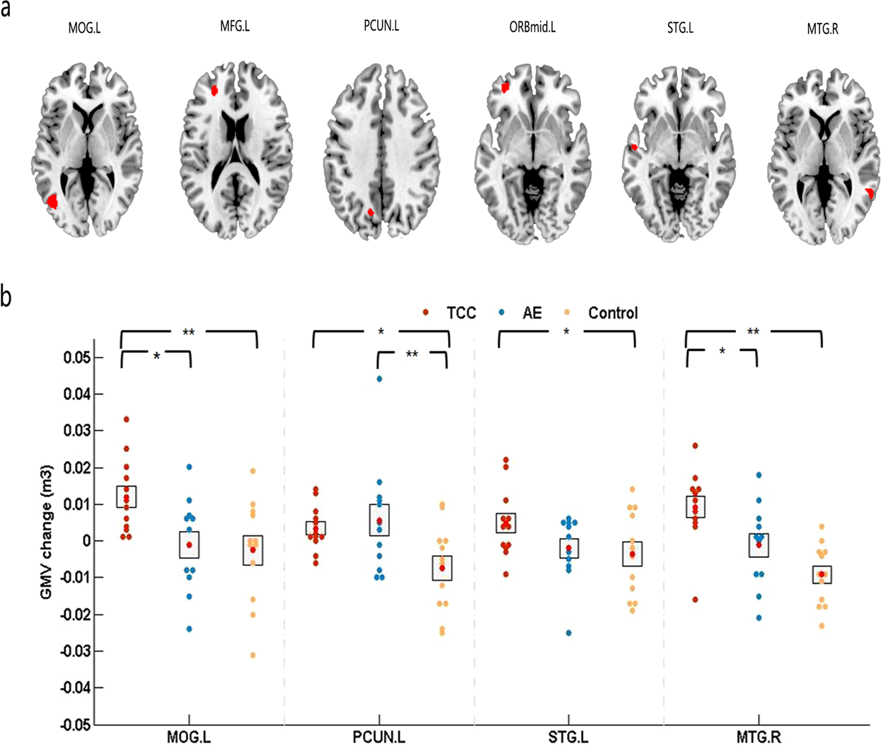 Tai Chi Chuan vs General Aerobic Exercise in Brain Plasticity: A Multimodal  MRI Study | Scientific Reports