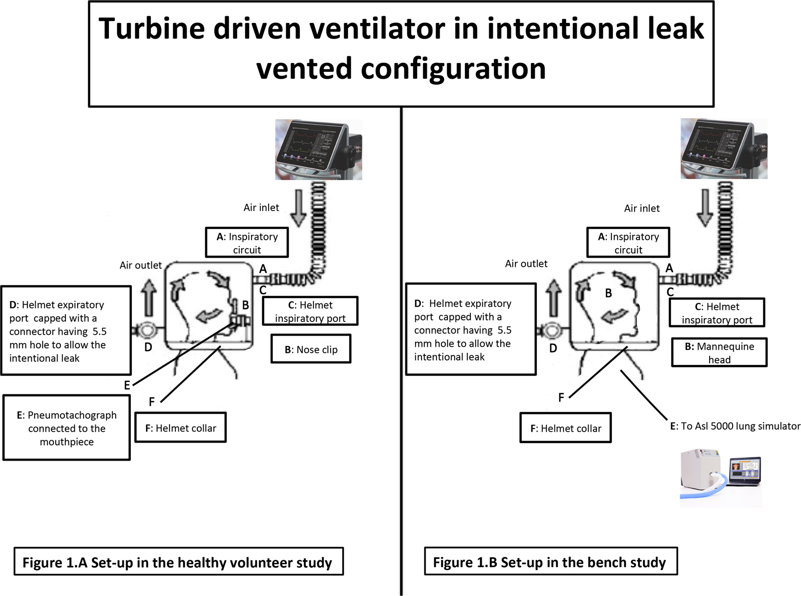 Tidal Volume Estimation during Helmet Noninvasive Ventilation: an  Experimental Feasibility Study | Scientific Reports