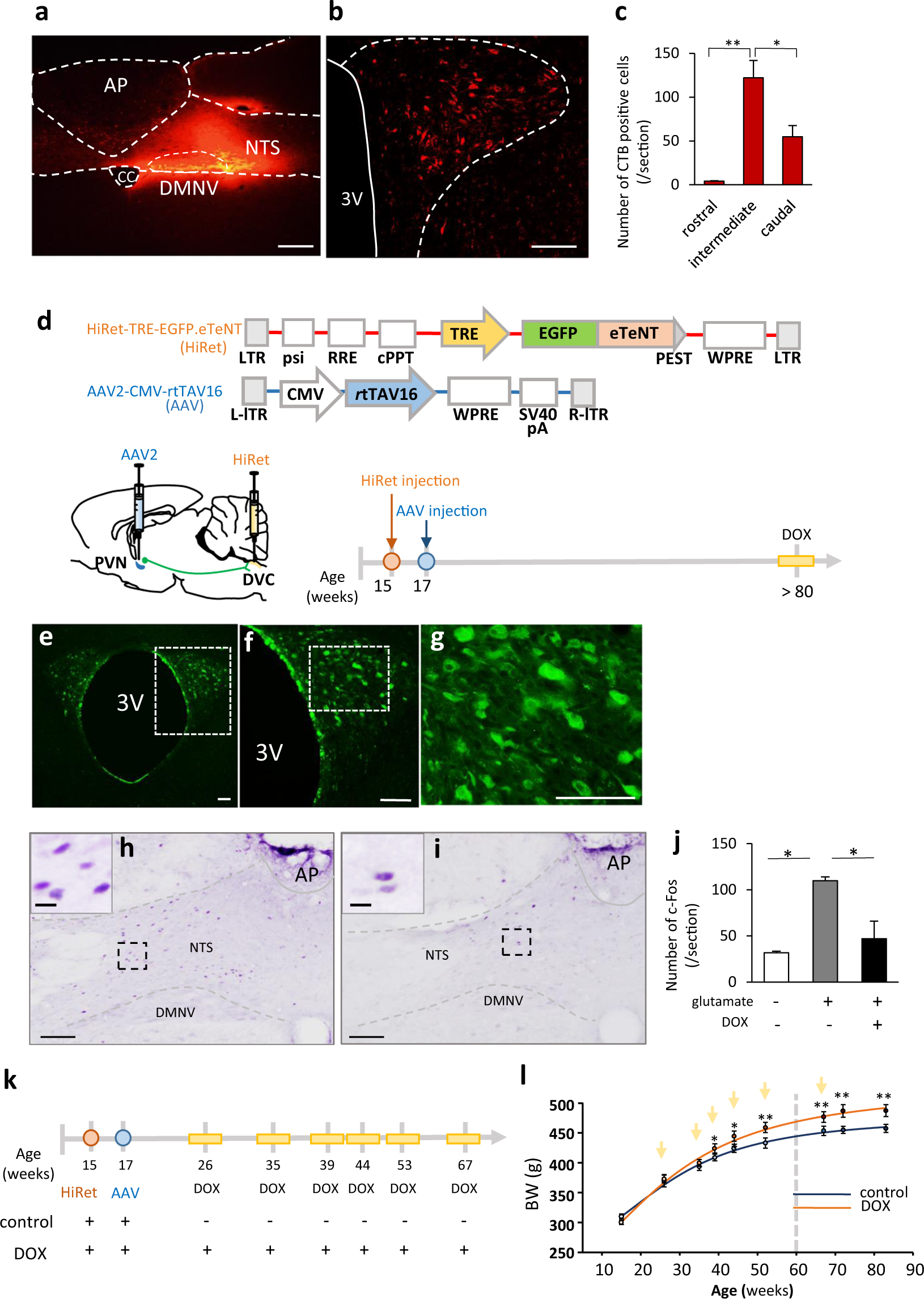 TrkB-expressing paraventricular hypothalamic neurons suppress appetite  through multiple neurocircuits
