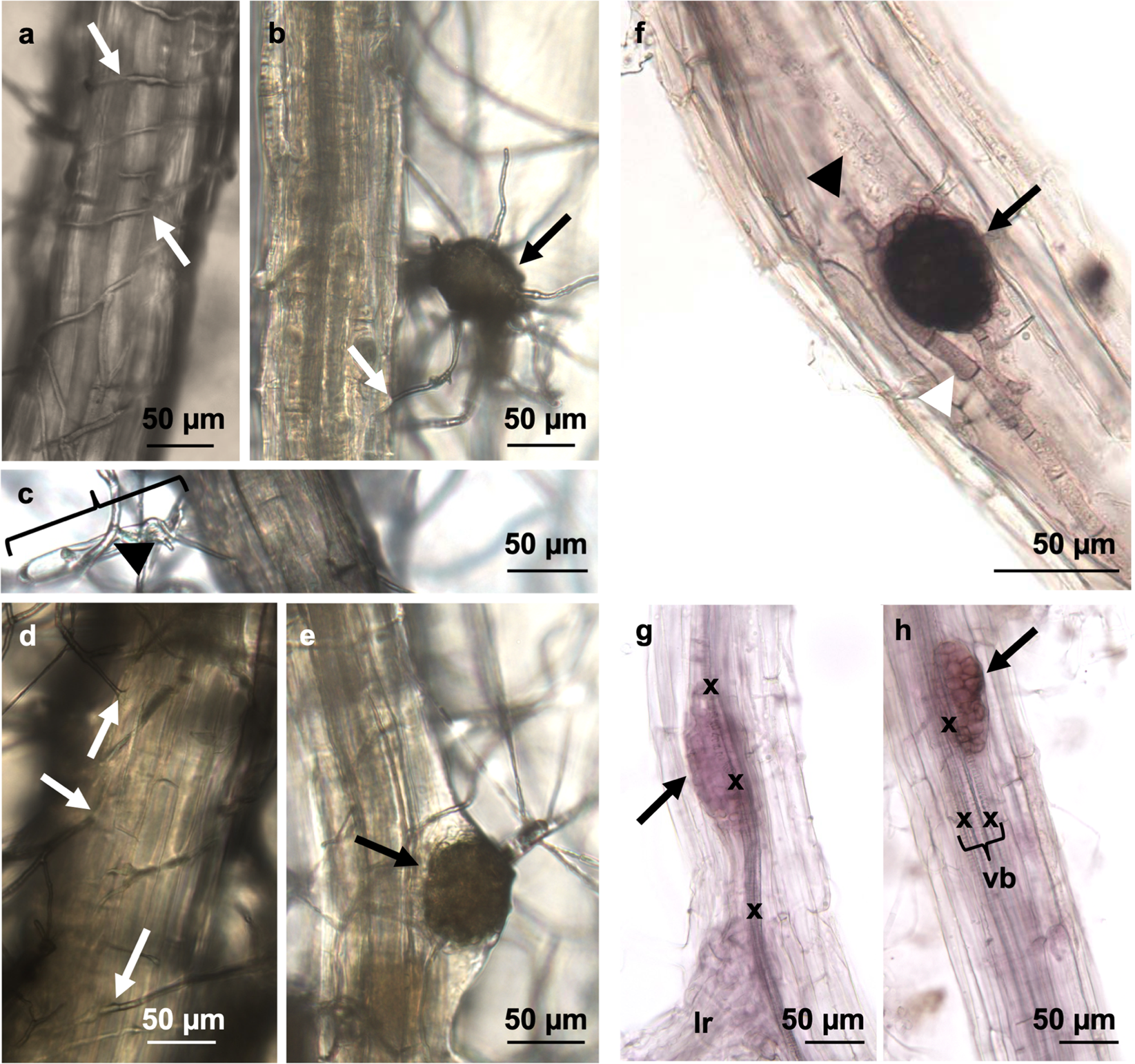 A Novel Arabidopsis Pathosystem Reveals Cooperation Of Multiple Hormonal Response Pathways In Host Resistance Against The Global Crop Destroyer Macrophomina Phaseolina Scientific Reports A Novel Arabidopsis Pathosystem Reveals Cooperation Of Multiple Hormonal Response Pathways In Host Resistance Against The Global Crop Destroyer Macrophomina Phaseolina Scientific Reports