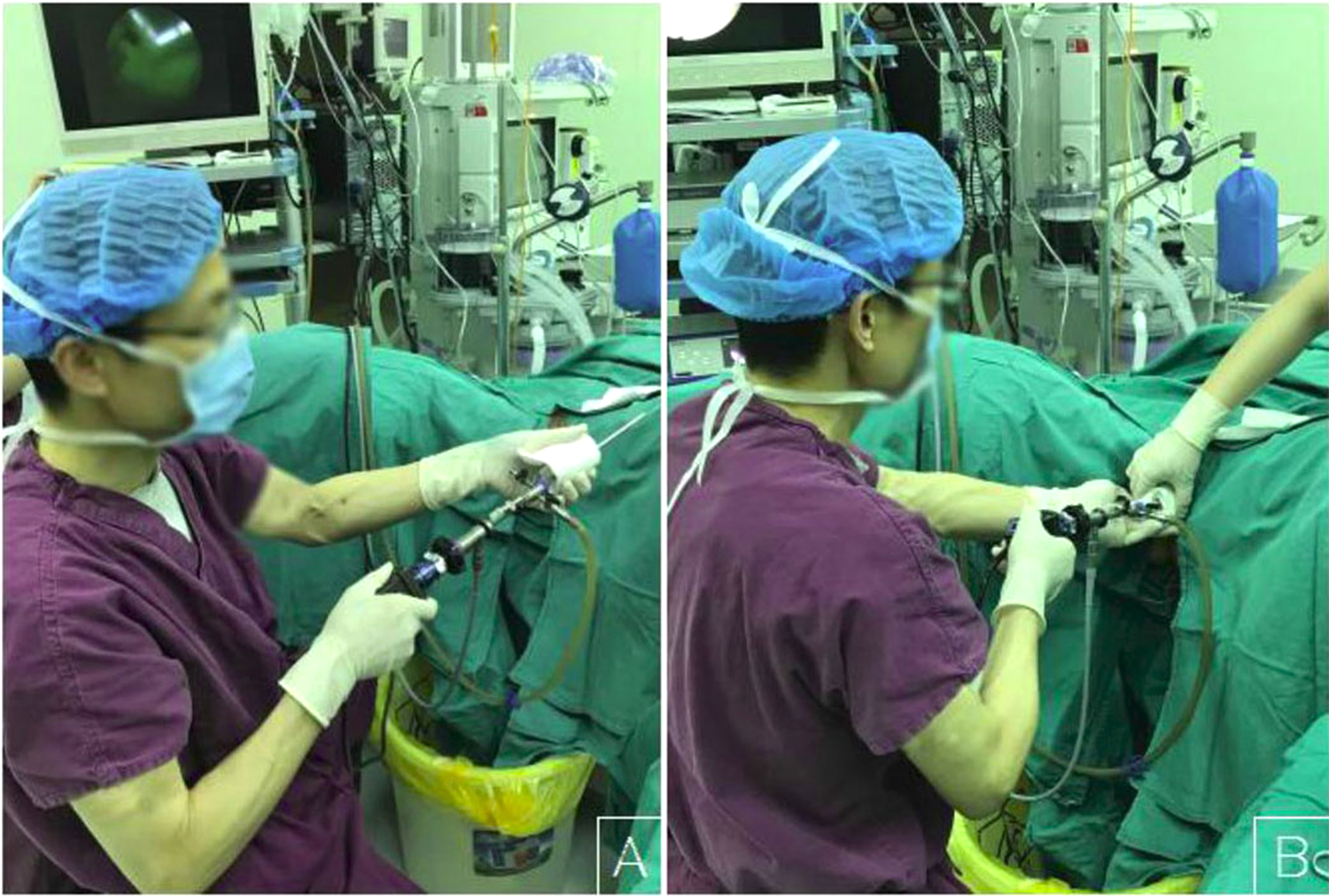 Paediatric vagina Vaginoscopic Incision of Oblique Vaginal Septum in Adolescents with OHVIRA  Syndrome | Scientific Reports