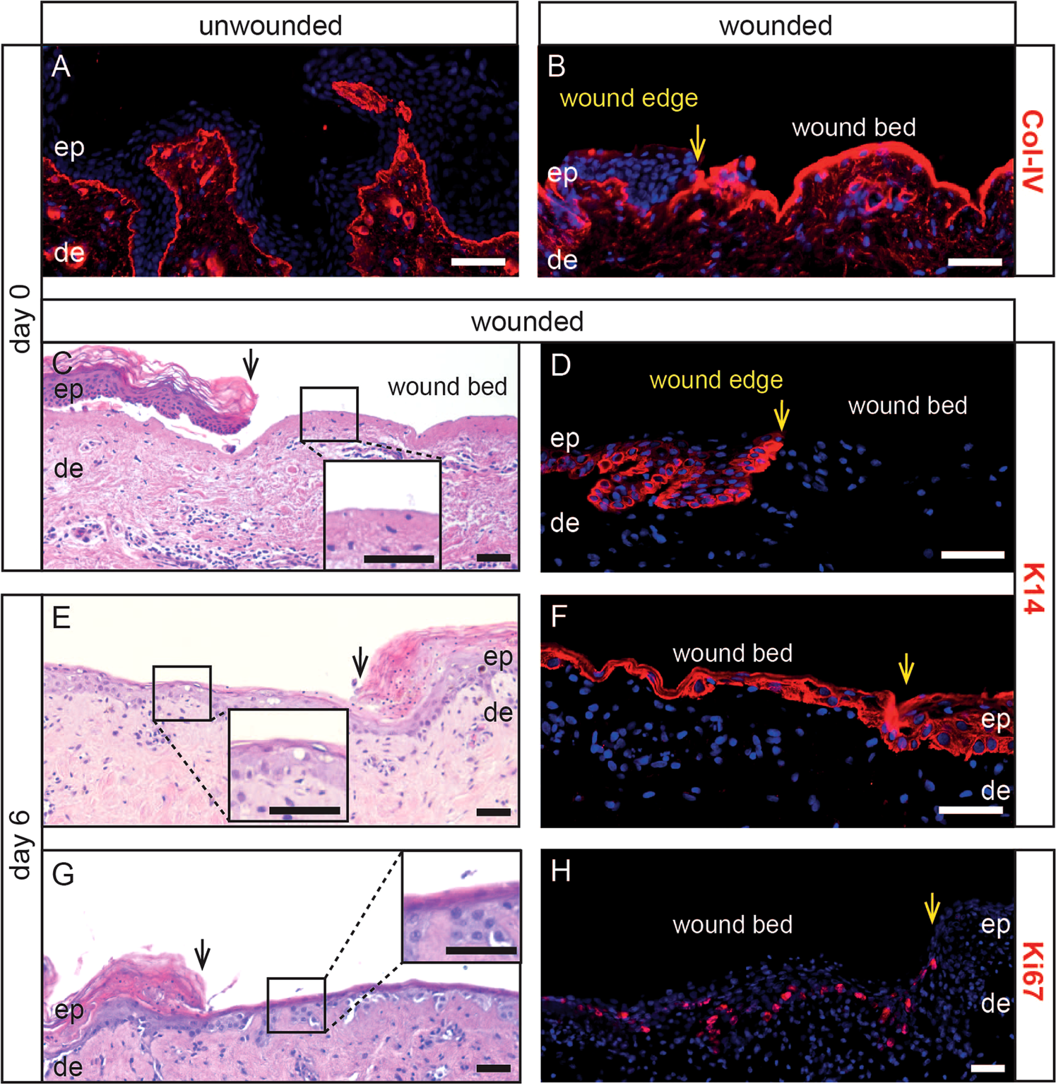 Re Epithelialization And Immune Cell Behaviour In An Ex Vivo Human Skin Model Scientific Reports