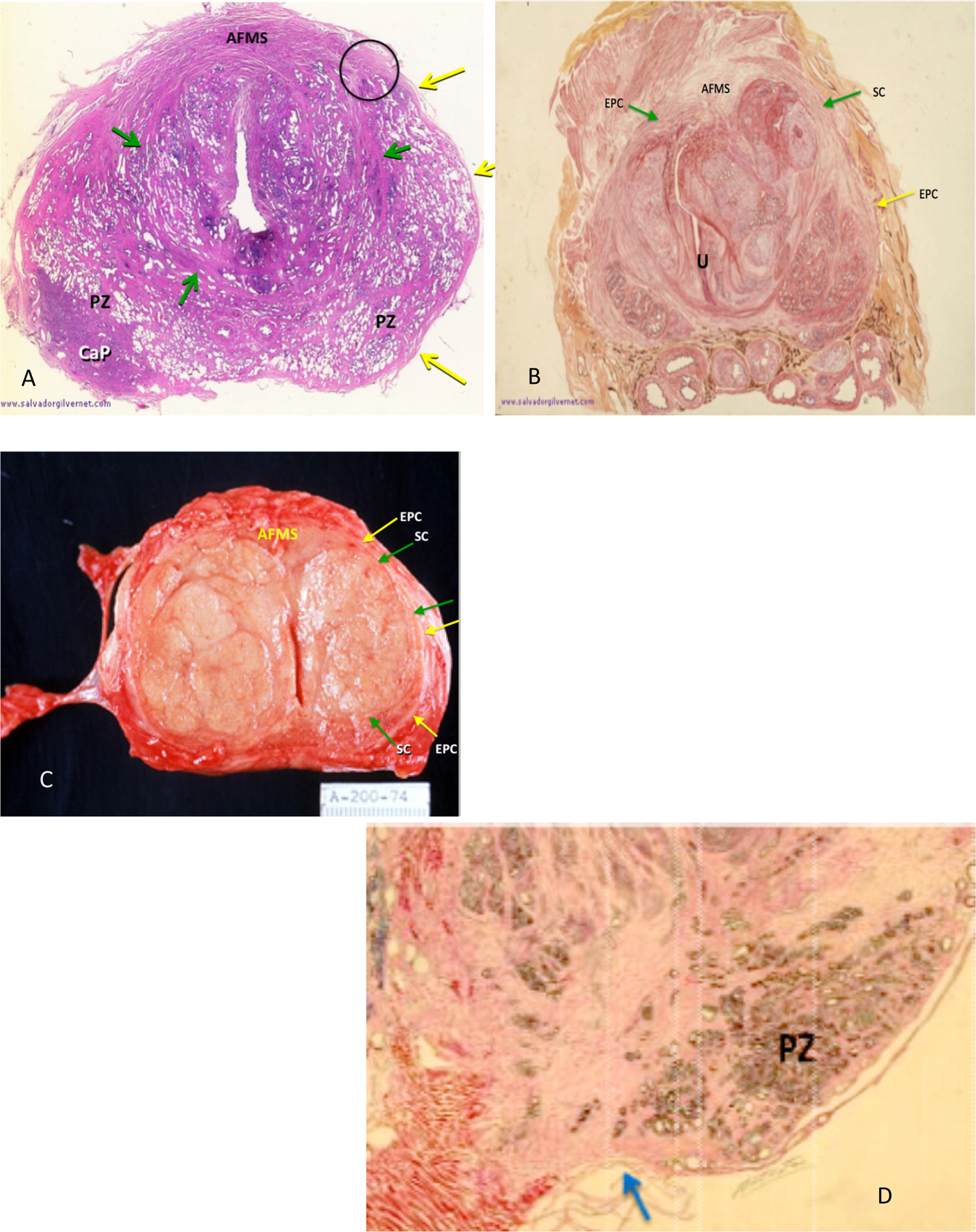 Measurement of Prostate Volume with MRI (A Guide for the Perplexed):  Biproximate Method with Analysis of Precision and Accuracy | Scientific  Reports