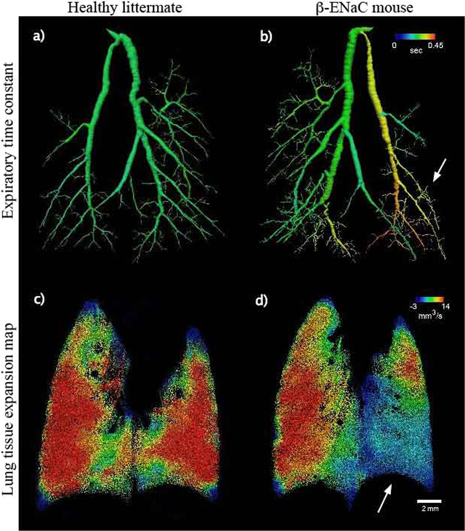 New Technology to Help Diagnose and Manage Respiratory Diseases New Technology to Help Diagnose and Manage Respiratory Diseases