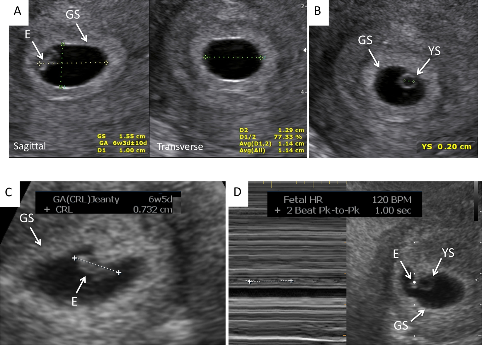 Pregnant Ultrasound Models
