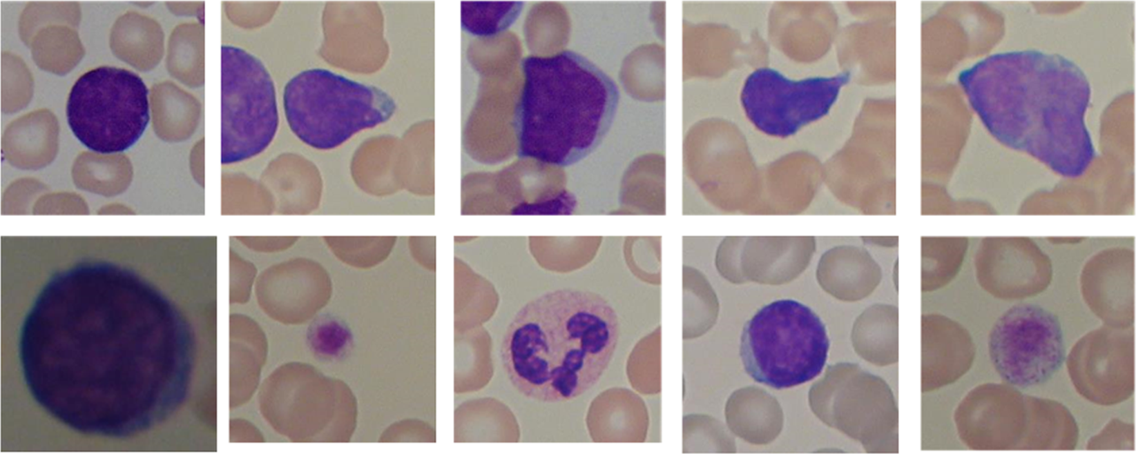 Efficient Classification of White Blood Cell Leukemia with Improved Swarm  Optimization of Deep Features | Scientific Reports