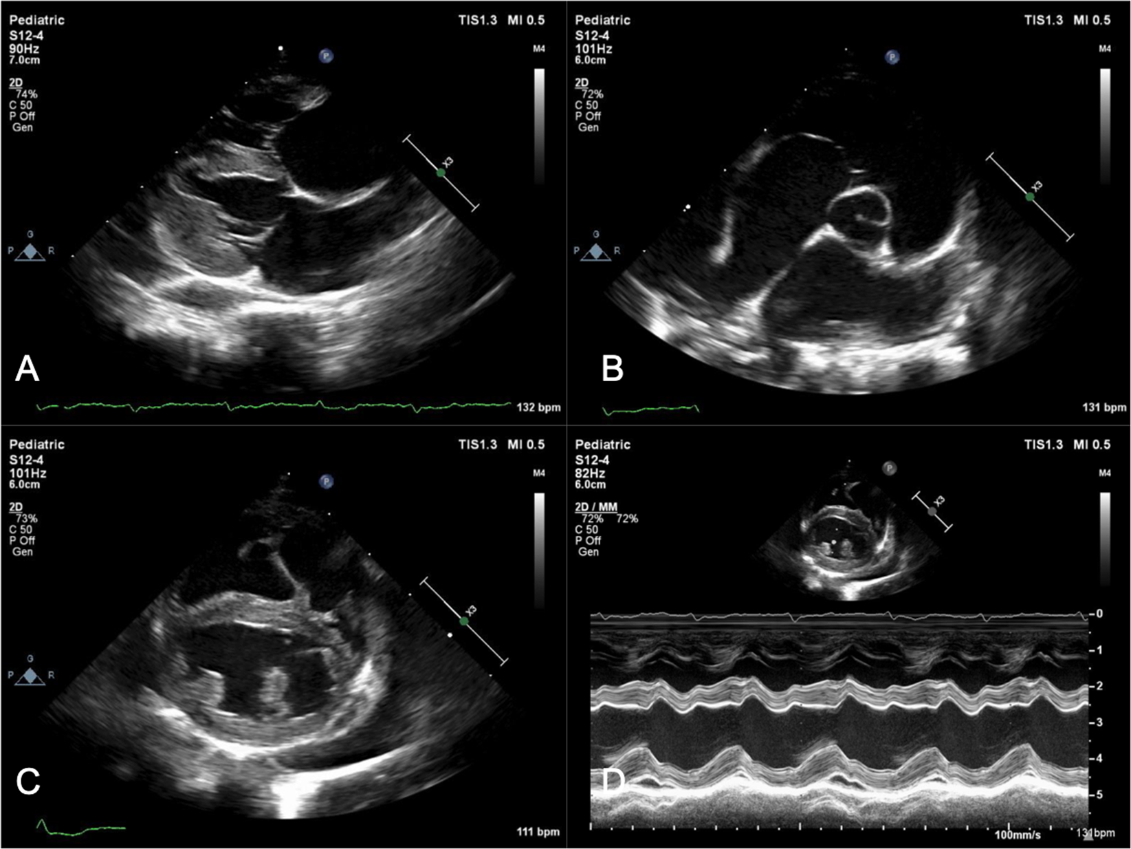 Cats with thermal burn injuries from California wildfires show  echocardiographic evidence of myocardial thickening and intracardiac  thrombi | Scientific Reports