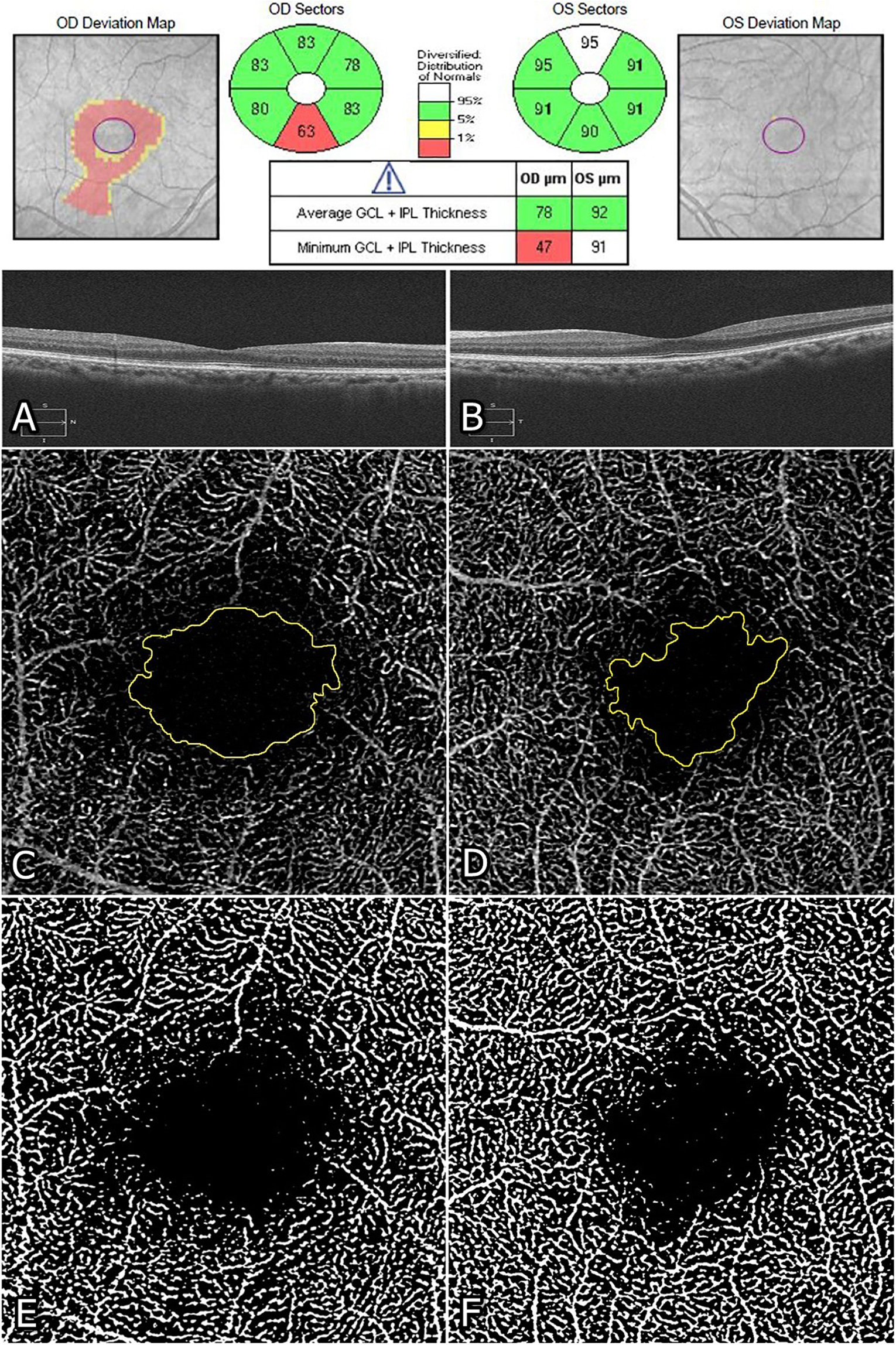 PDF] Multivariate cube integrated retinal variable to visually