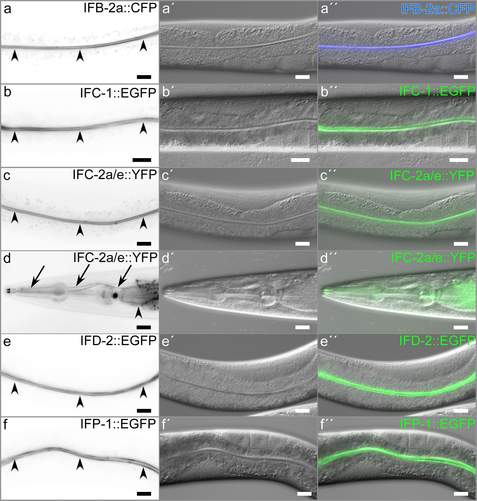 Intestinal Intermediate Filament Polypeptides In C Elegans Common And Isotype Specific Contributions To Intestinal Ultrastructure And Function Scientific Reports