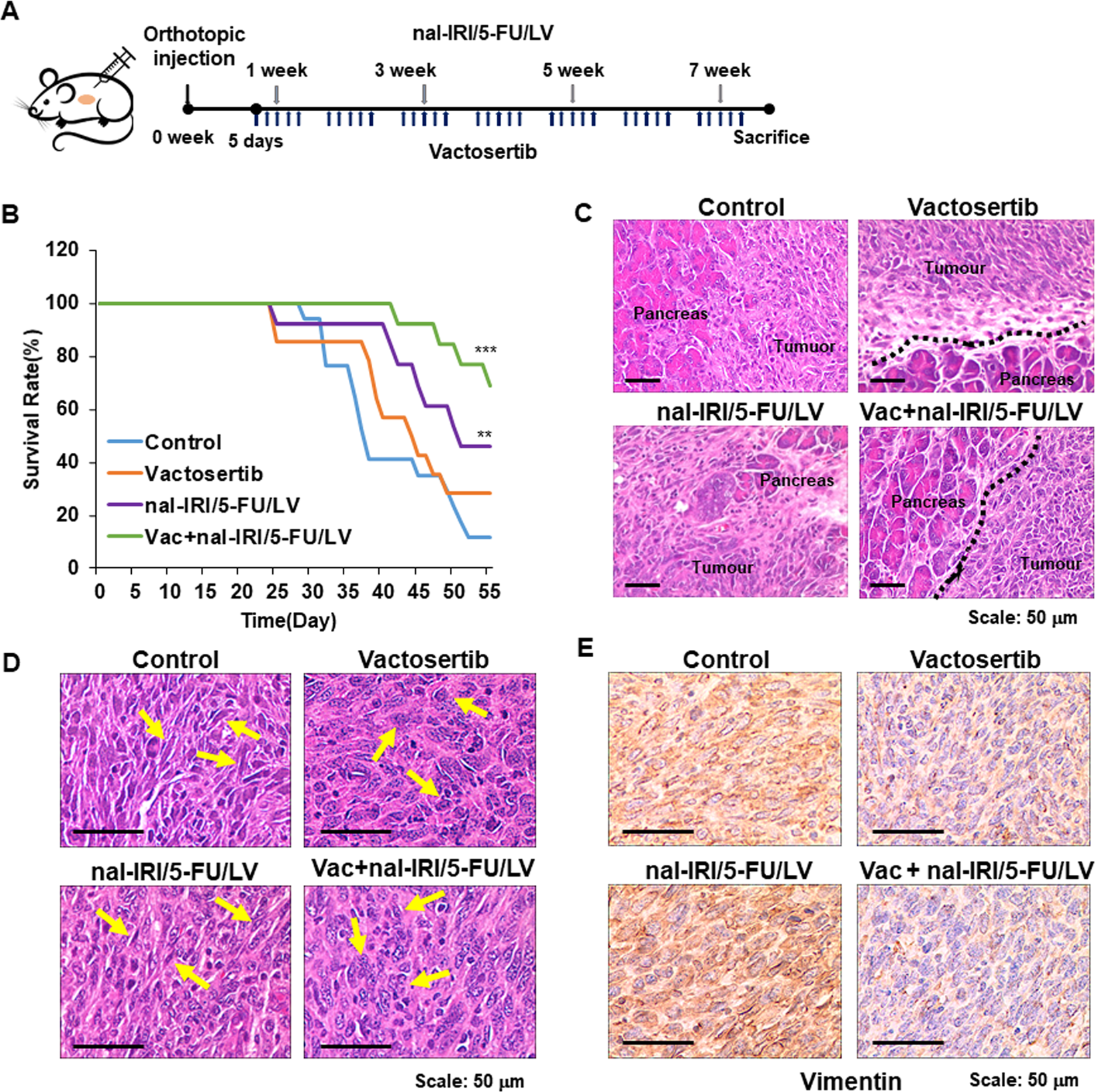 Inhibition Of Tgf B Signalling In Combination With Nal Iri Plus 5 Fluorouracil Leucovorin Suppresses Invasion And Prolongs Survival In Pancreatic Tumour Mouse Models Scientific Reports