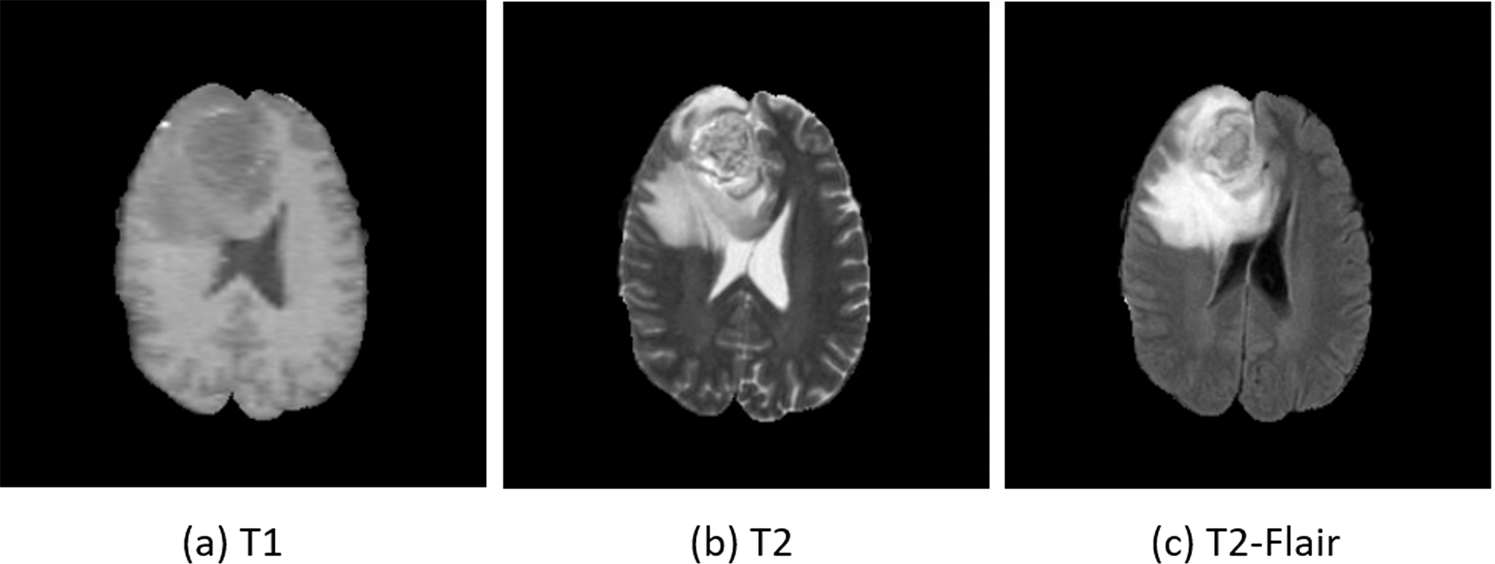 MRI Cross-Modality Image-to-Image Translation | Scientific