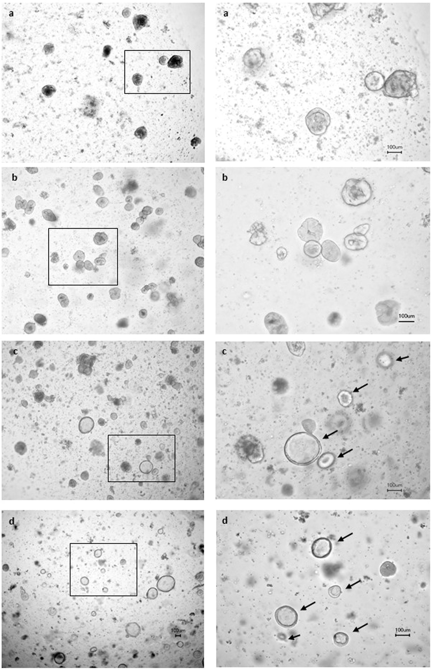 Intestinal ex vivo organoid culture reveals altered programmed crypt stem  cells in patients with celiac disease | Scientific Reports