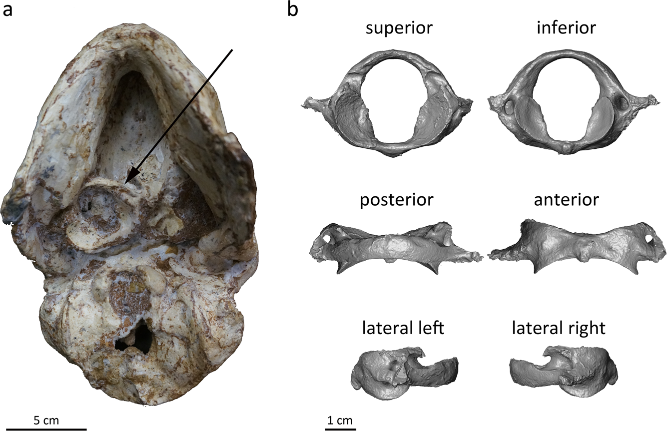 The atlas of StW 573 and the late emergence of human-like head mobility and  brain metabolism | Scientific Reports, image size:1335x863