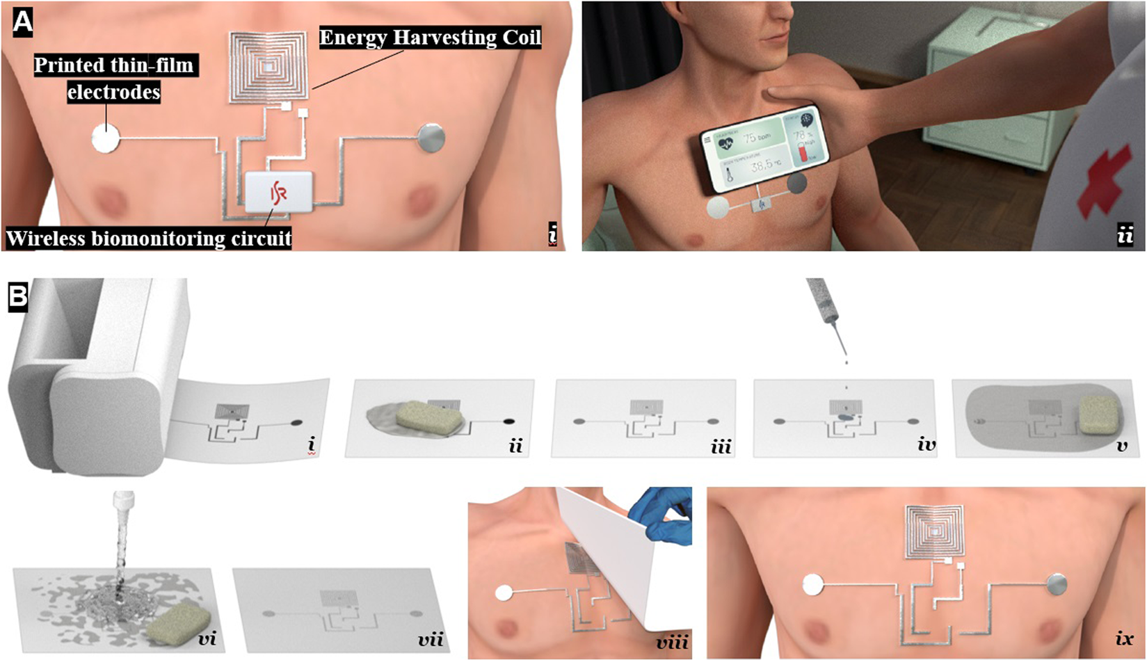 A Personalized Electronic Tattoo for Healthcare Realized by OntheSpot  Assembly of an Intrinsically Conductive and Durable LiquidMetal Composite   Lee  2022  Advanced Materials  Wiley Online Library