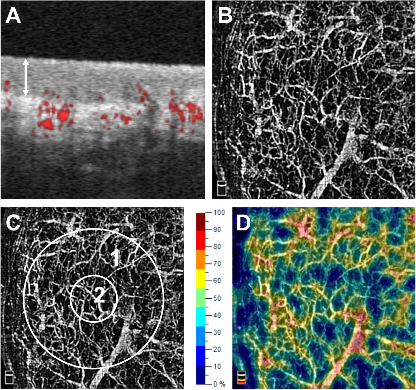 Optical coherence tomography angiography as a novel approach to contactless  evaluation of sublingual microcirculation: A proof of principle study |  Scientific Reports