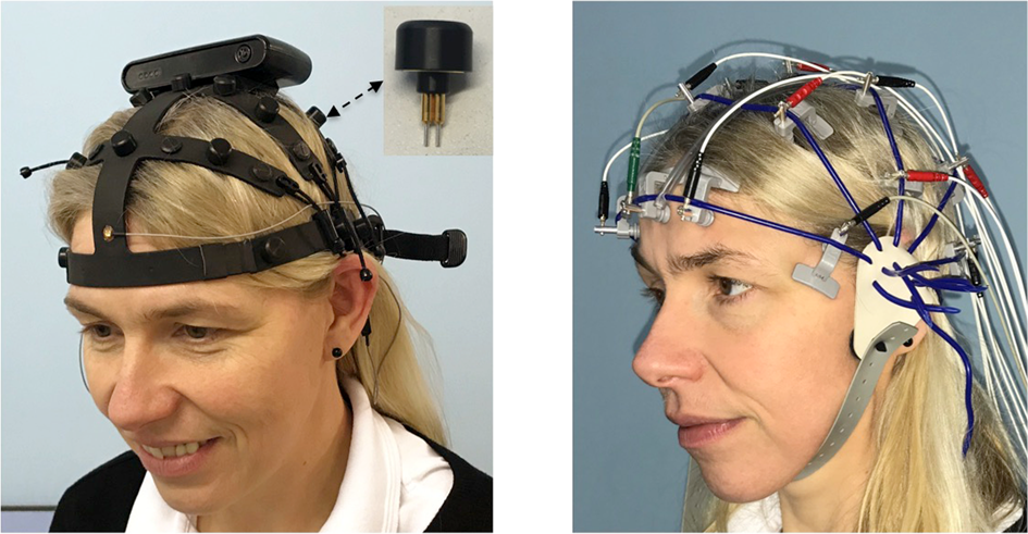 Comparison between a wireless dry electrode EEG system with a conventional  wired wet electrode EEG system for clinical applications | Scientific  Reports