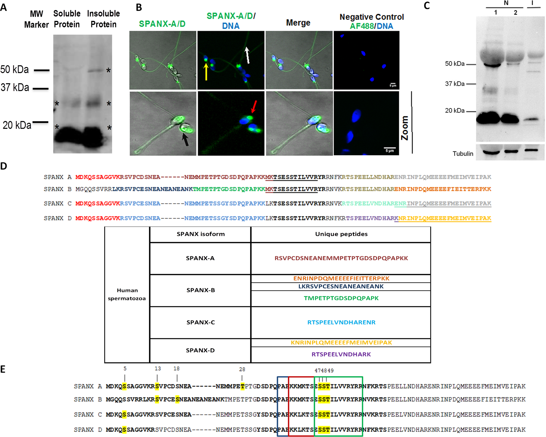 SPANX-A/D protein subfamily plays a key role in nuclear organisation,  metabolism and flagellar motility of human spermatozoa