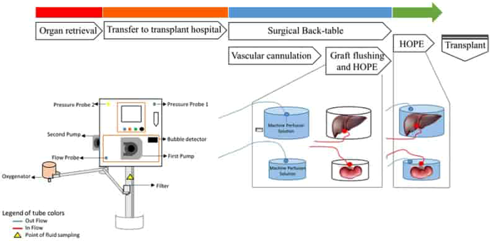 Hypothermic Oxygenated New Machine Perfusion System in Liver and Kidney  Transplantation of Extended Criteria Donors:First Italian Clinical Trial |  Scientific Reports