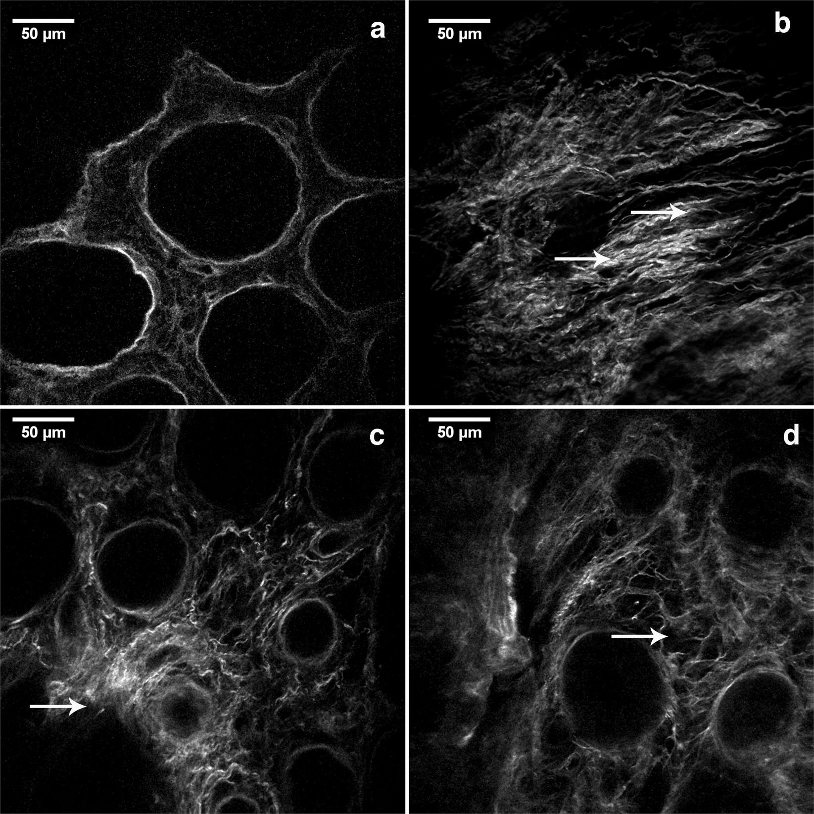 Altered organization of collagen fibers in the uninvolved human colon  mucosa 10 cm and 20 cm away from the malignant tumor | Scientific Reports