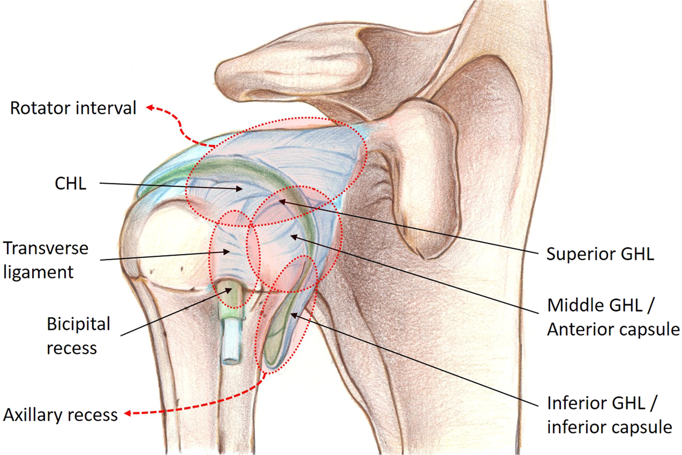 Typical magnetic resonance imaging scan showing the coracohumeral