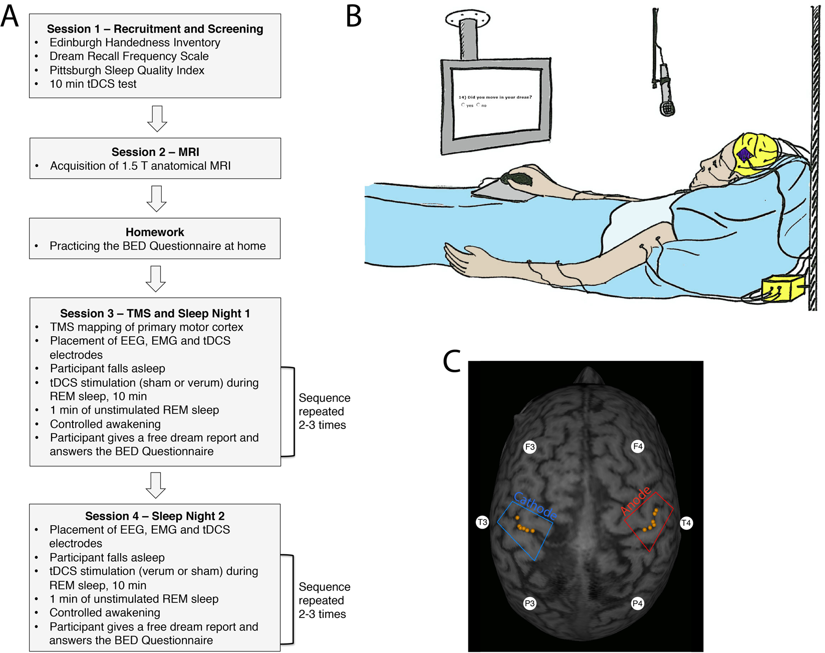 Modulating dream experience: Noninvasive brain stimulation over the  sensorimotor cortex reduces dream movement | Scientific Reports