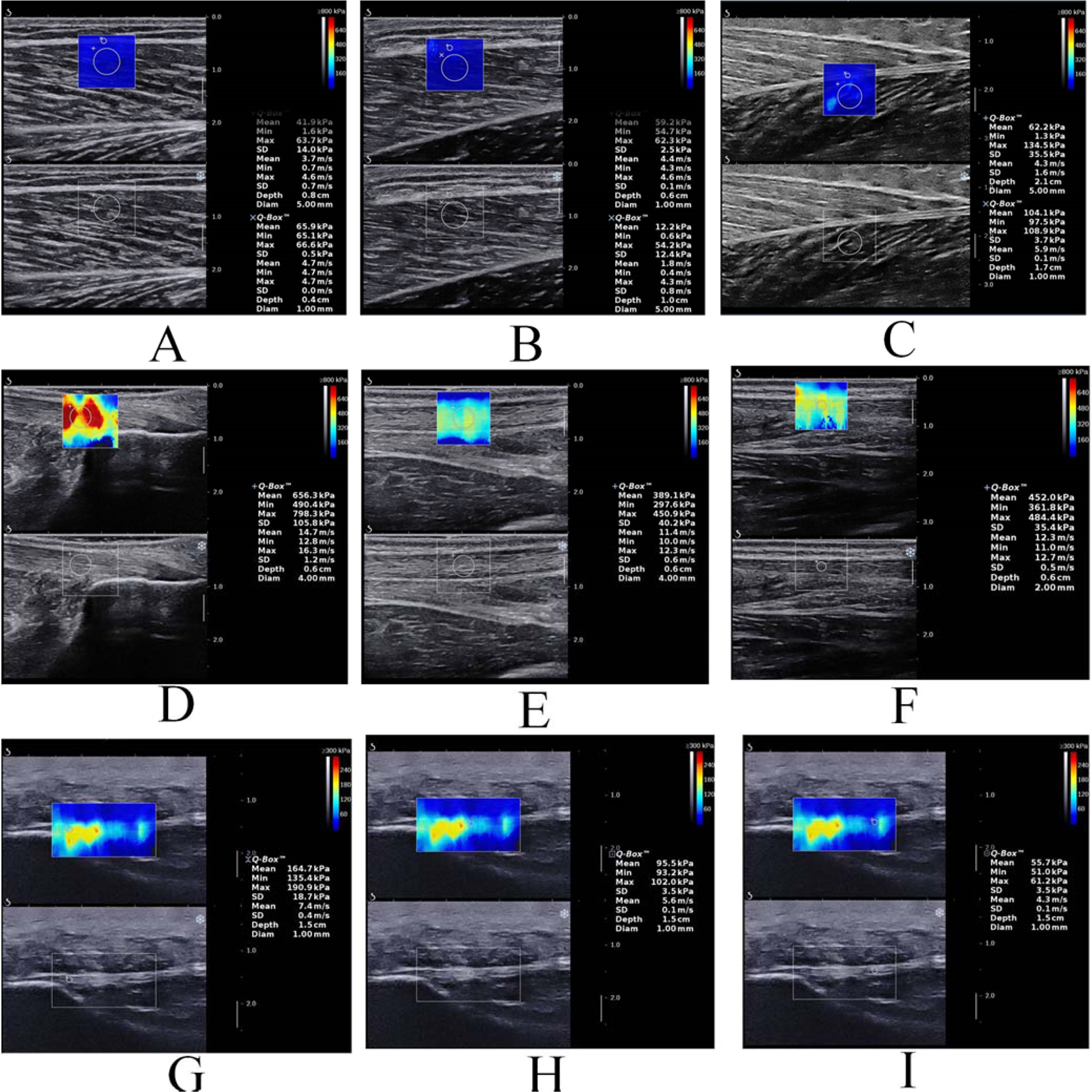 Influence of different knee and ankle ranges of motion on the elasticity of  triceps surae muscles, Achilles tendon, and plantar fascia | Scientific  Reports