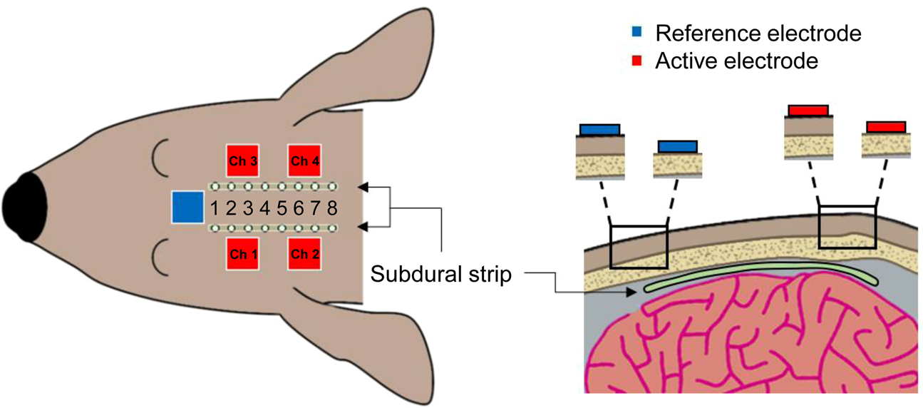 Example of transdermal electric muscle stimulation by means of a