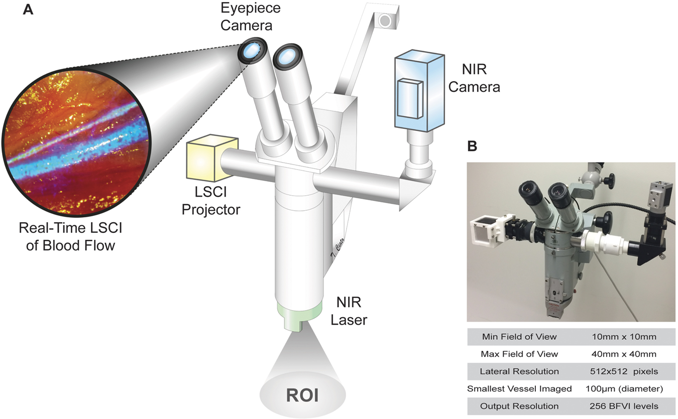 Intraoperative Laser Speckle Contrast Imaging For Real-Time Visualization  of Cerebral Blood Flow in Cerebrovascular Surgery: Results From  Pre-Clinical Studies | Scientific Reports