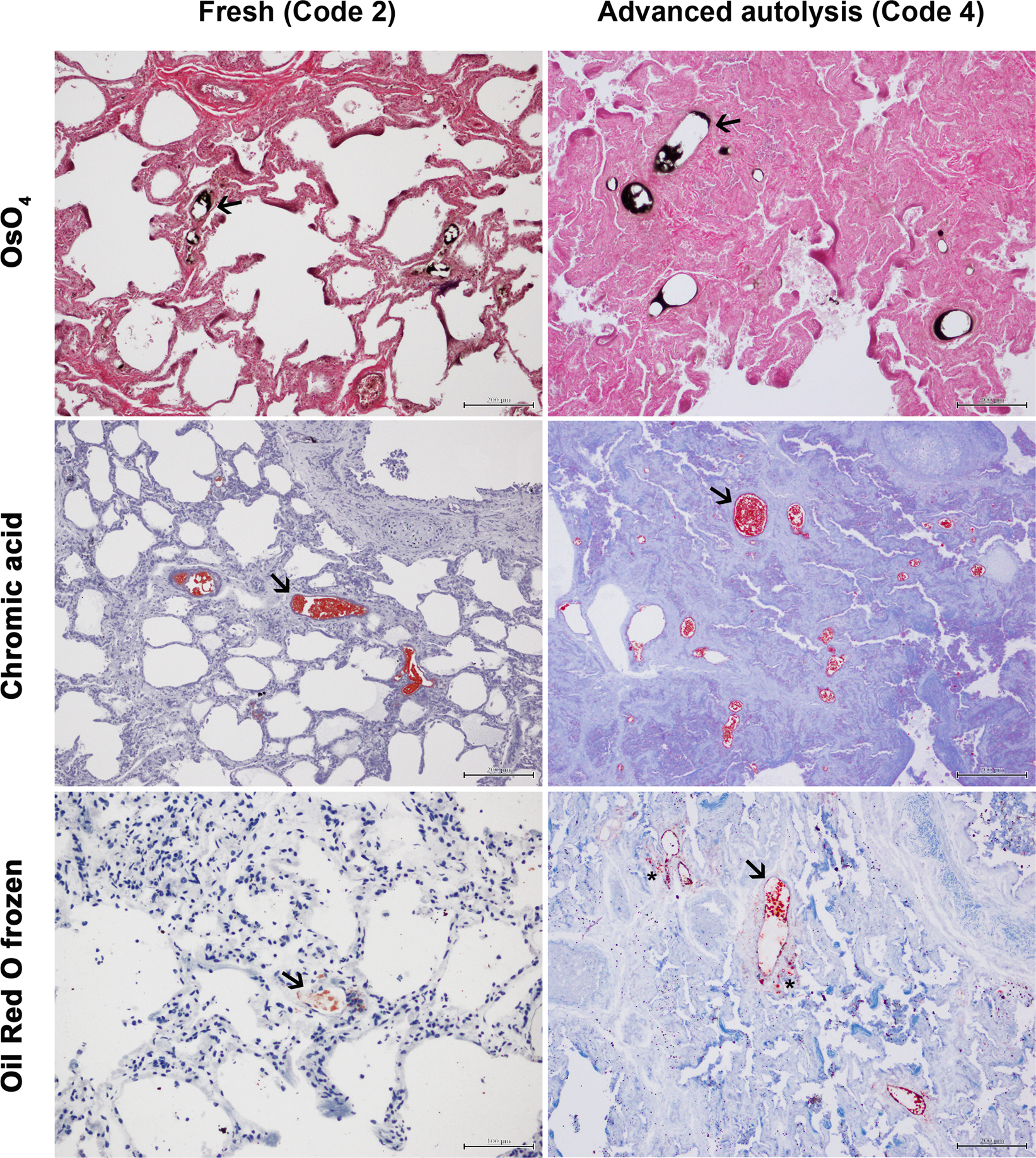 Comparison Of Three Histological Techniques For Fat Emboli Detection In Lung Cetacean S Tissue Scientific Reports