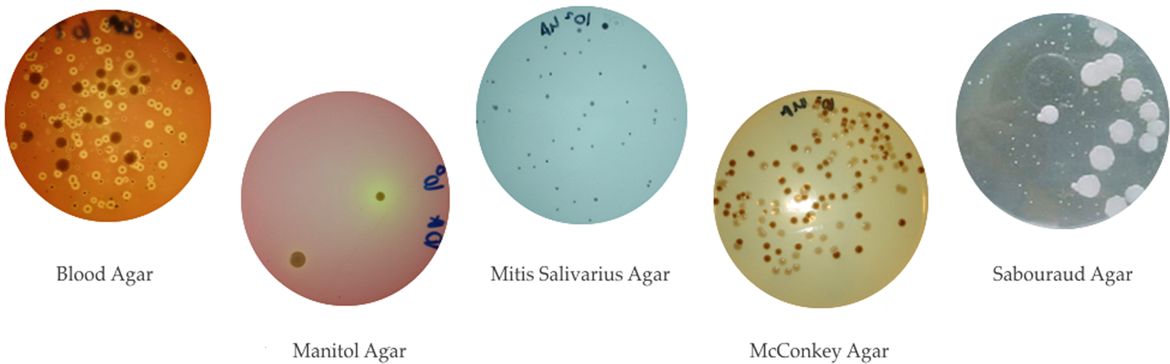 Effect of antiseptic gels in the microbiologic colonization of the suture  threads after oral surgery | Scientific Reports, image size:1643x512