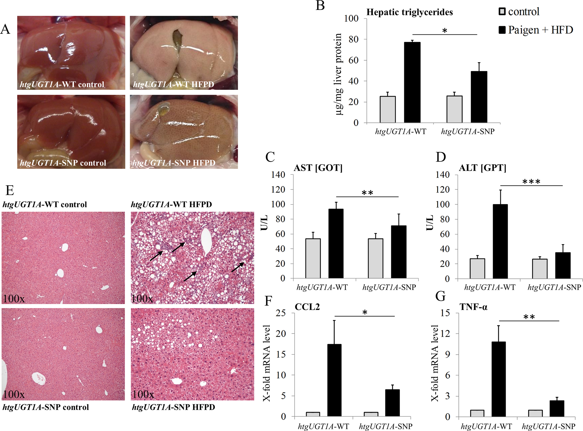A Gilbert Syndrome Associated Haplotype Protects Against Fatty Liver Disease In Humanized Transgenic Mice Scientific Reports A Gilbert Syndrome Associated Haplotype Protects Against Fatty Liver Disease In Humanized Transgenic Mice Scientific Reports