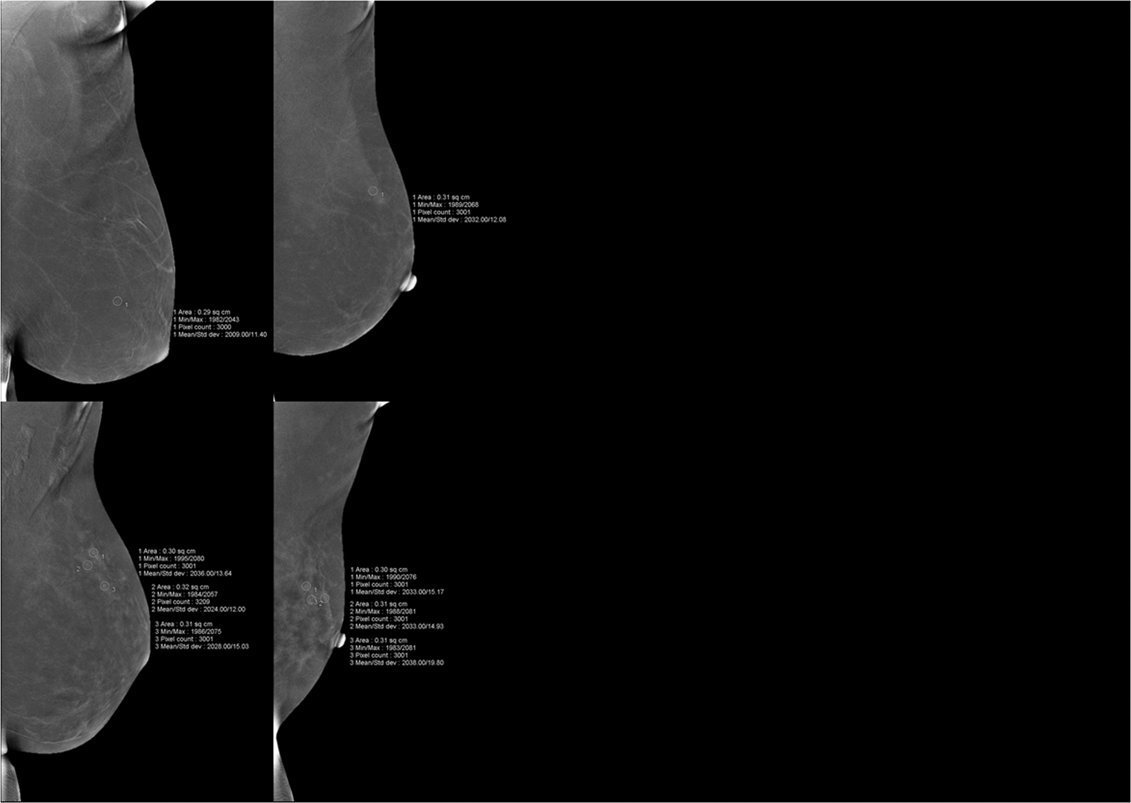 Background Parenchymal Enhancement On Contrast Enhanced Spectral Mammography Influence Of Age Breast Density Menstruation Status And Menstrual Cycle Timing Scientific Reports Background Parenchymal Enhancement On Contrast Enhanced Spectral Mammography Influence Of Age Breast Density Menstruation Status And Menstrual Cycle Timing Scientific Reports