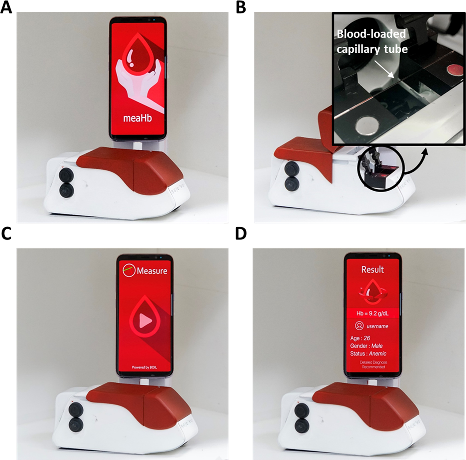 A Portable Smartphone-linked Device for Direct, Rapid and Chemical-Free  Hemoglobin Assay | Scientific Reports