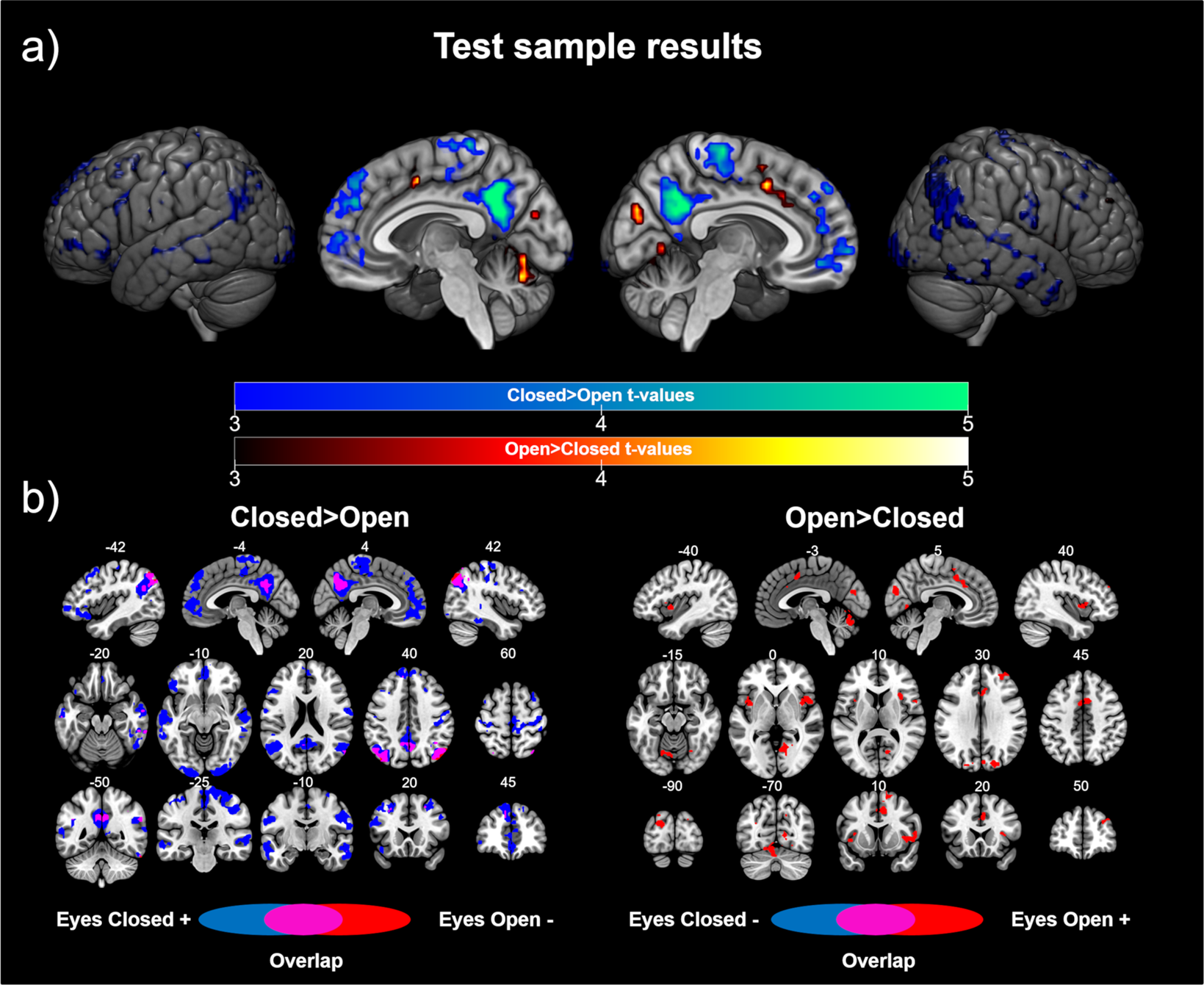 Opening or closing eyes at rest modulates the functional connectivity of V1  with default and salience networks | Scientific Reports