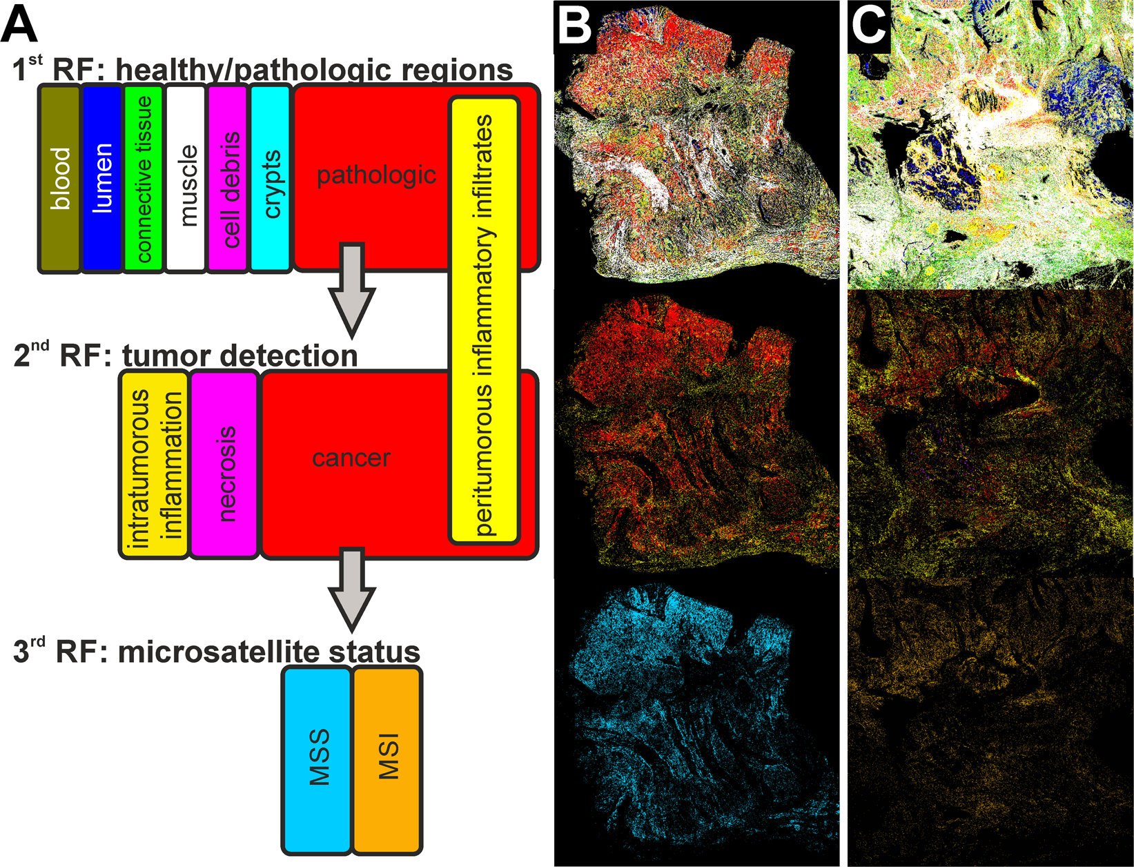 Label-free, automated classification of microsatellite status in colorectal  cancer by infrared imaging | Scientific Reports