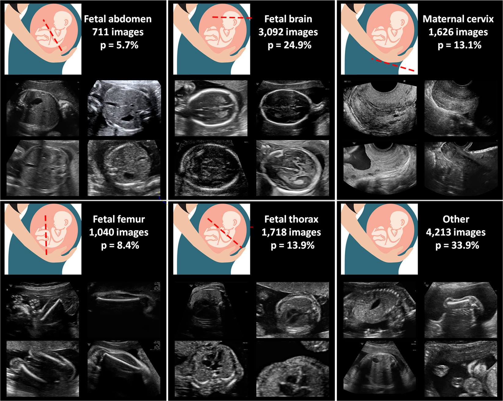 research projects in ultrasound