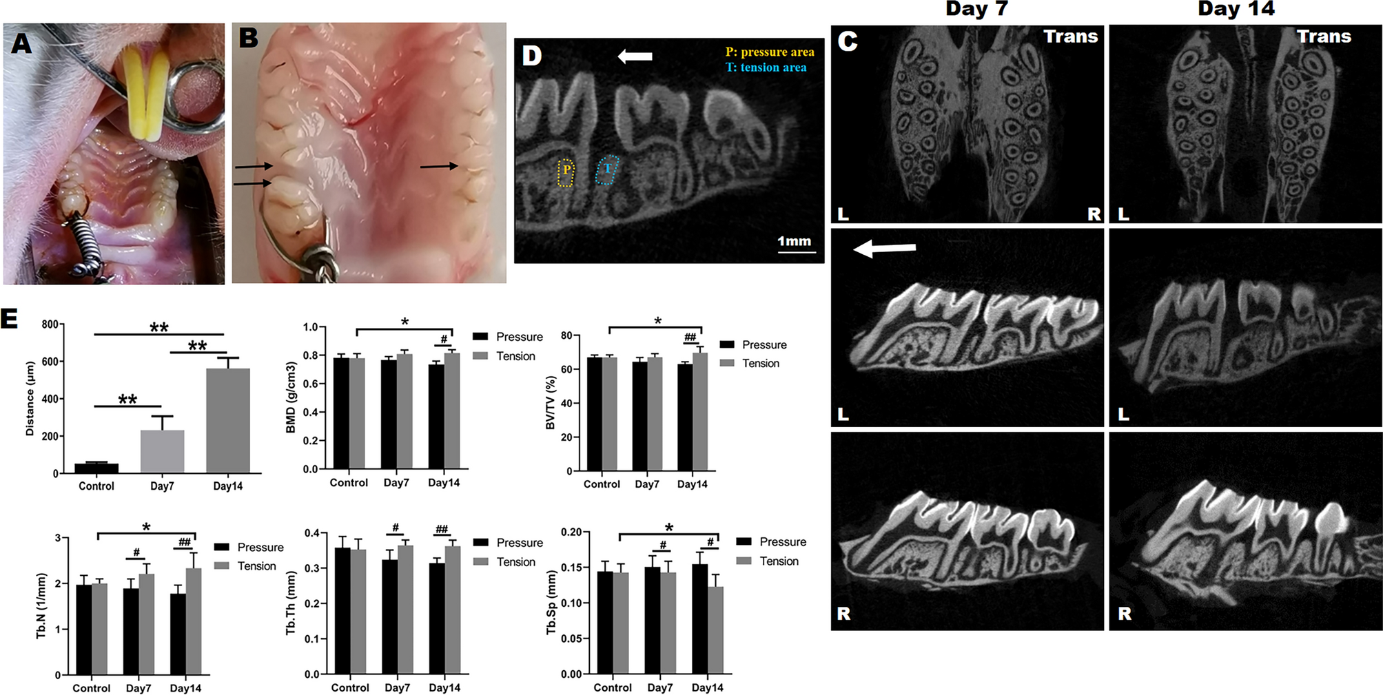 Tensile force-induced PDGF-BB/PDGFRβ signals in periodontal ligament  fibroblasts activate JAK2/STAT3 for orthodontic tooth movement | Scientific  Reports