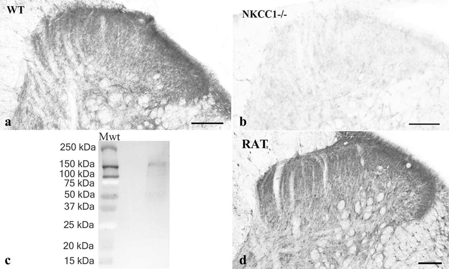 Differential expression of Na+/K+/Cl− cotransporter 1 in neurons 