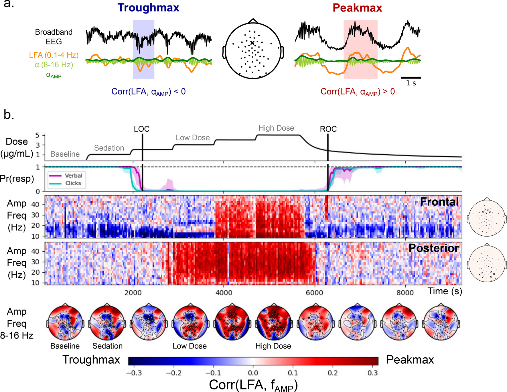 Broadband Slow Wave Modulation In Posterior And Anterior Cortex Tracks Distinct States Of Propofol Induced Unconsciousness Scientific Reports