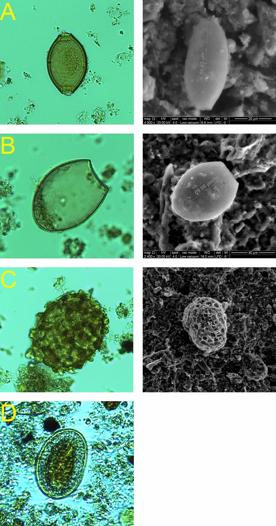 Can You Vacuum Up Giardia Cysts: Effective Cleaning Tips