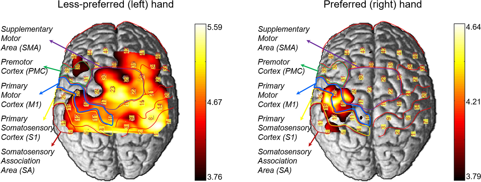 The Psychology of Left-Handed Brain Differences