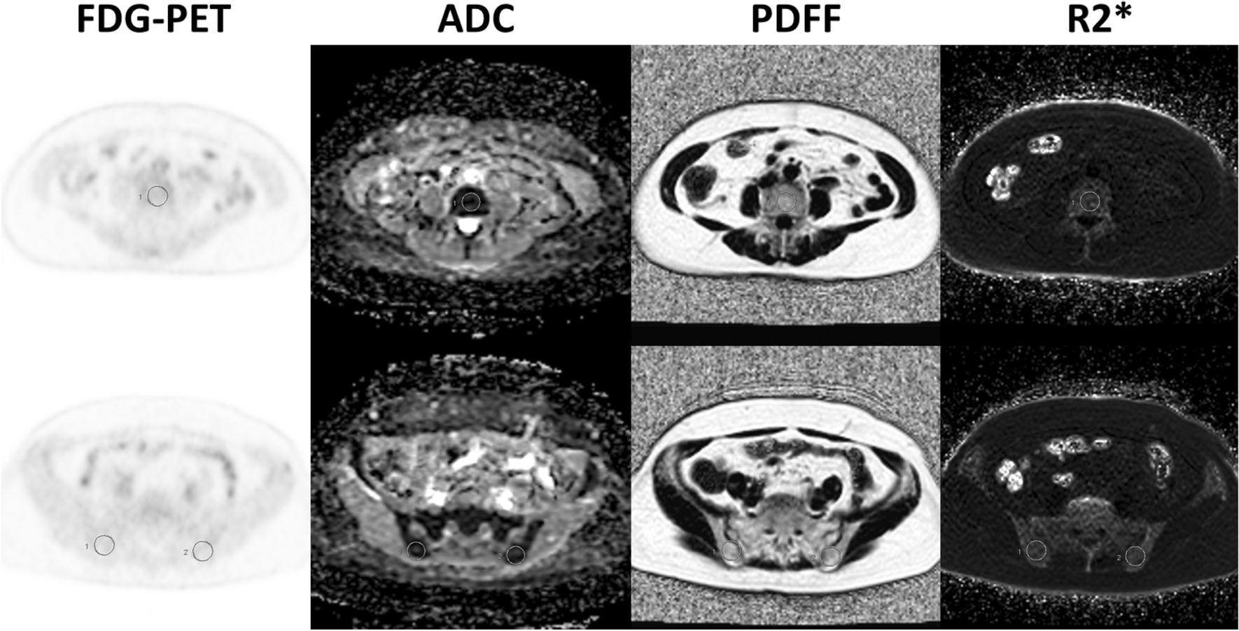 [18F]FDG PET/MRI demonstrates the iron-related physiology Scientific Reports