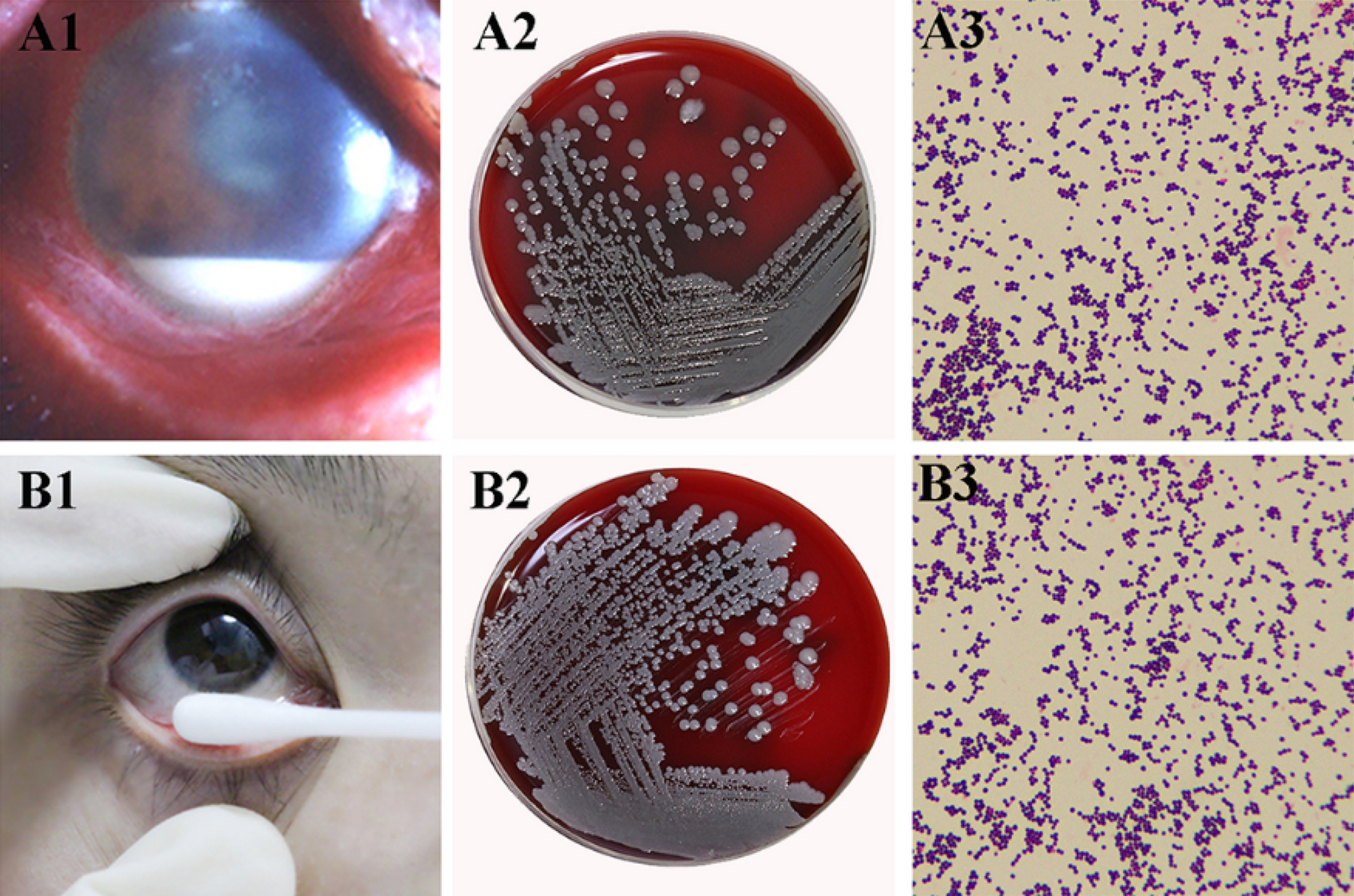 Staphylococcus epidermidis: Trends in Microbiology