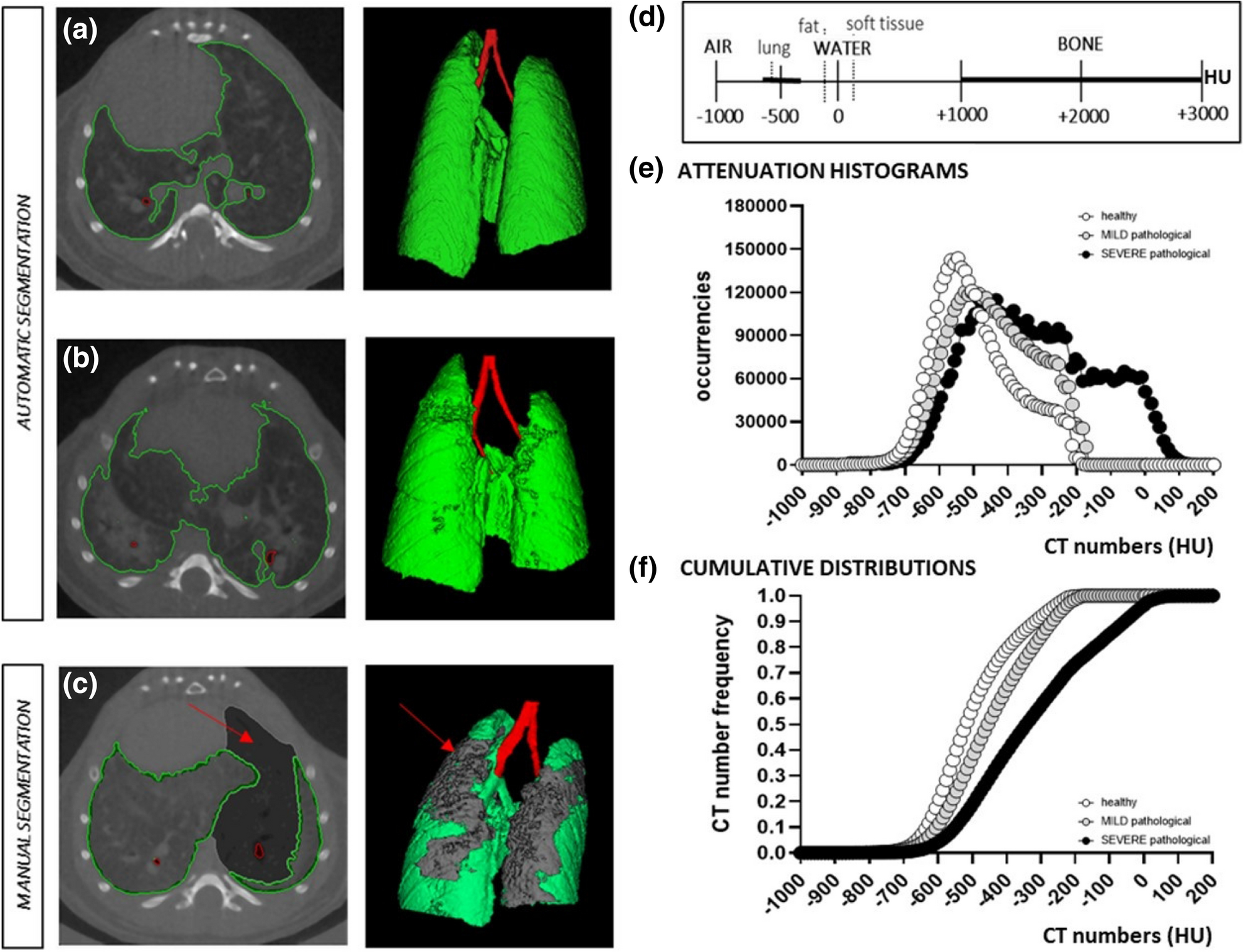 In-vivo lung fibrosis staging in a bleomycin-mouse model: a new micro-CT  guided densitometric approach | Scientific Reports