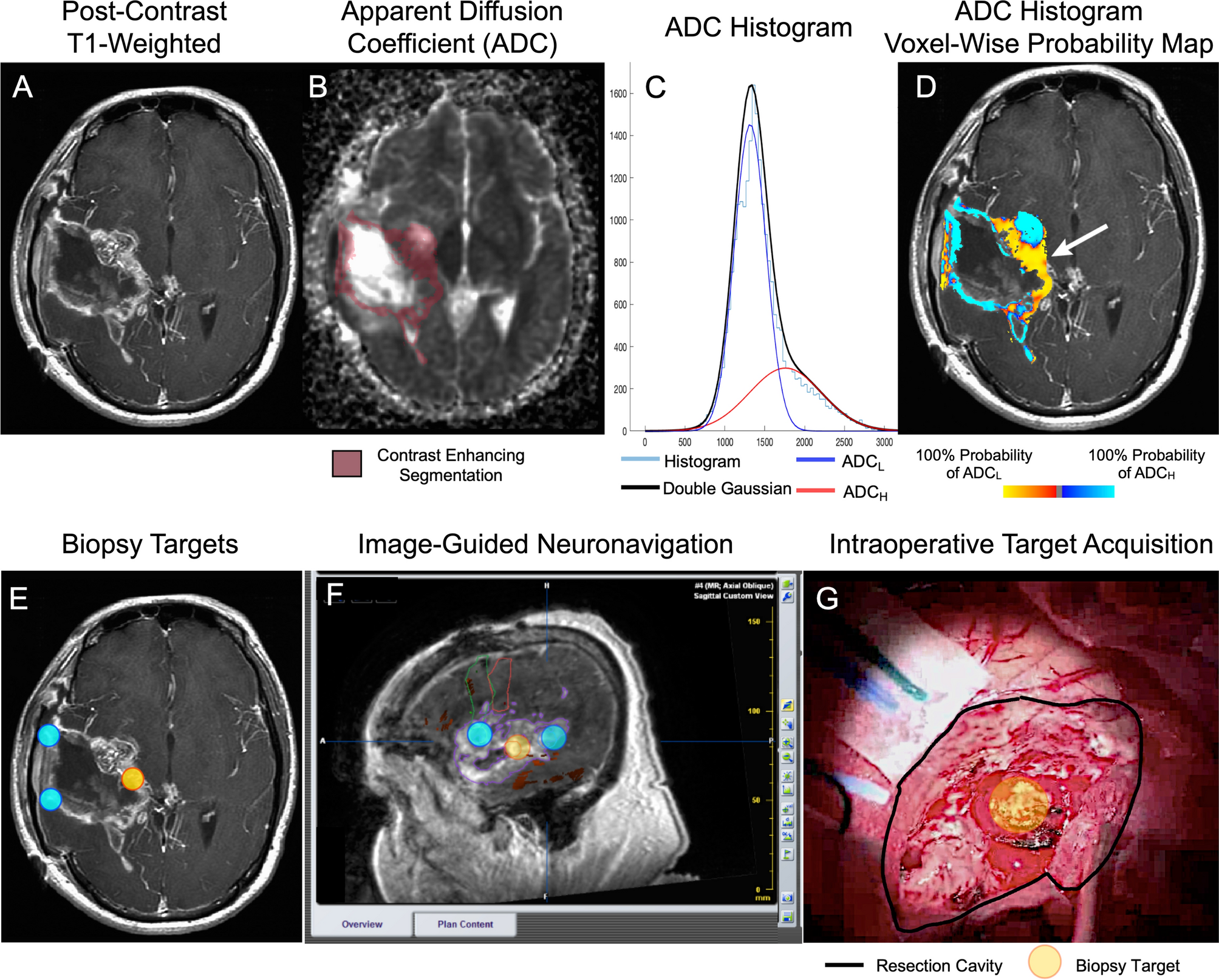 High-resolution magnetic resonance imaging of the efficacy