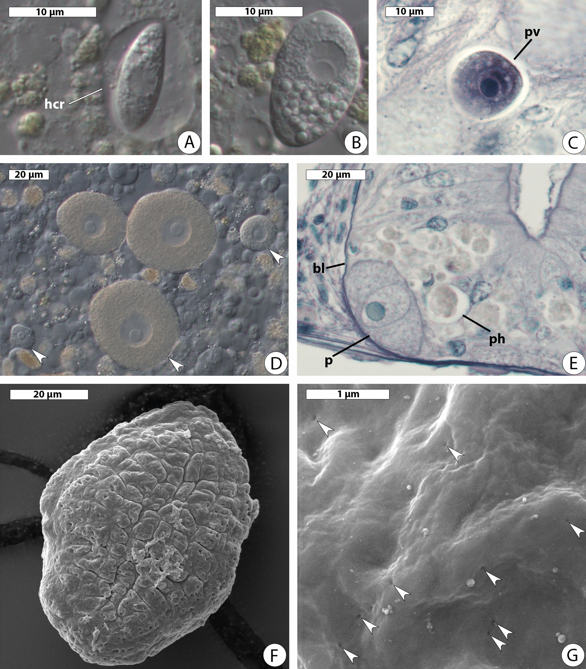 Polyphyletic origin, intracellular invasion, and meiotic genes in the  putatively asexual agamococcidians (Apicomplexa incertae sedis) |  Scientific Reports