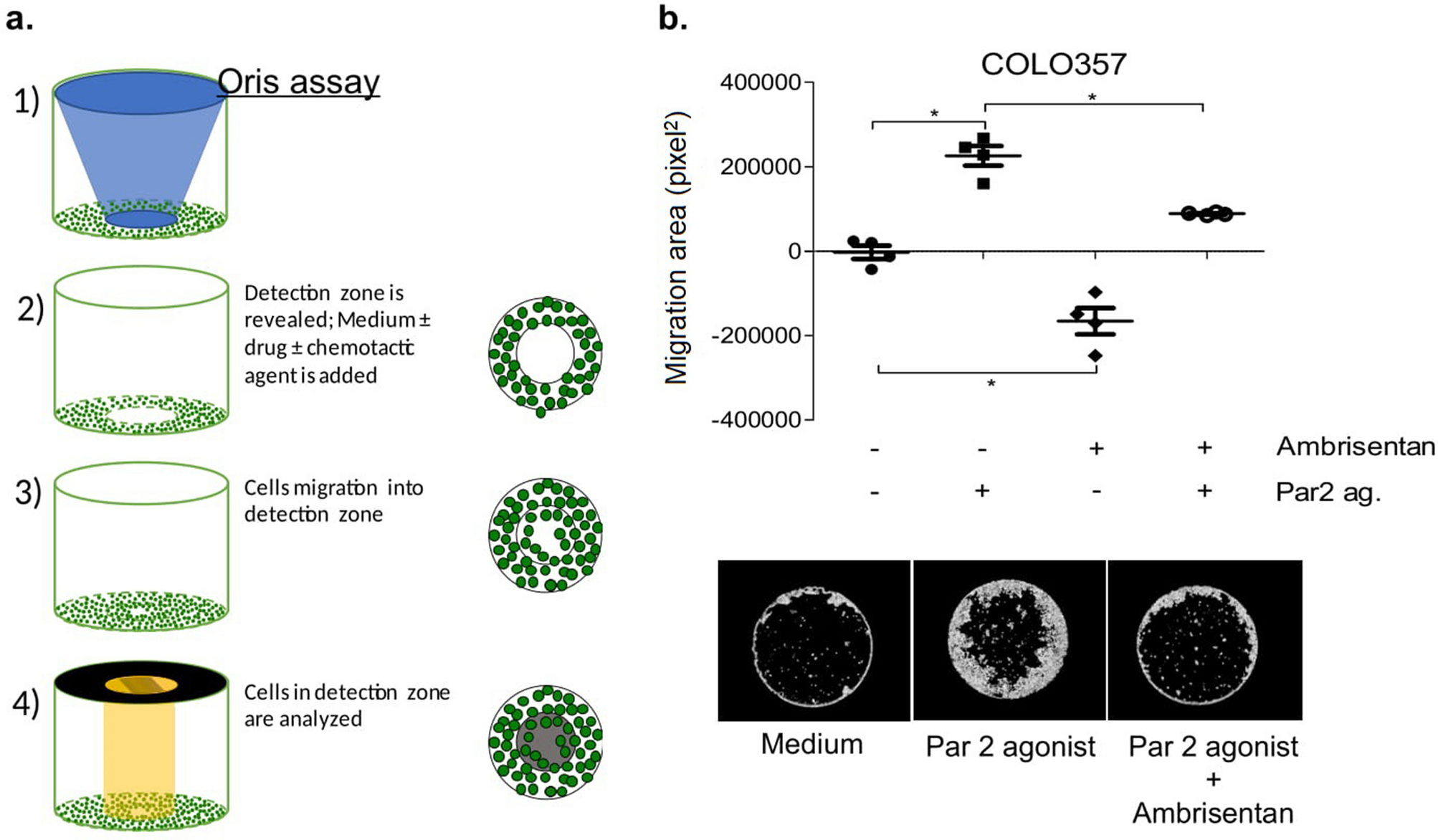 Ambrisentan, an endothelin receptor type A-selective antagonist, inhibits  cancer cell migration, invasion, and metastasis | Scientific Reports